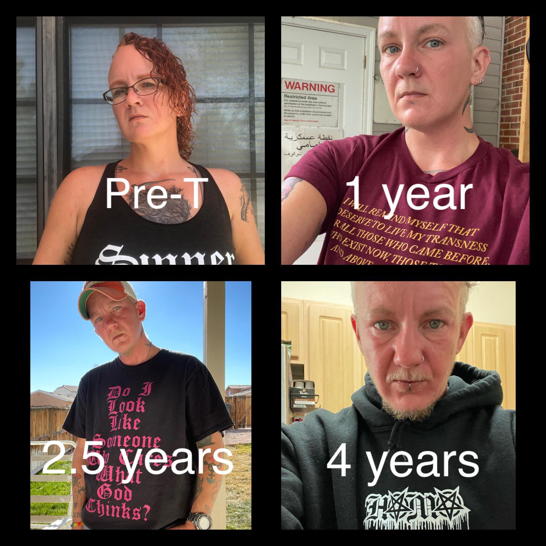 FtM, 4 years on T : transtimelines