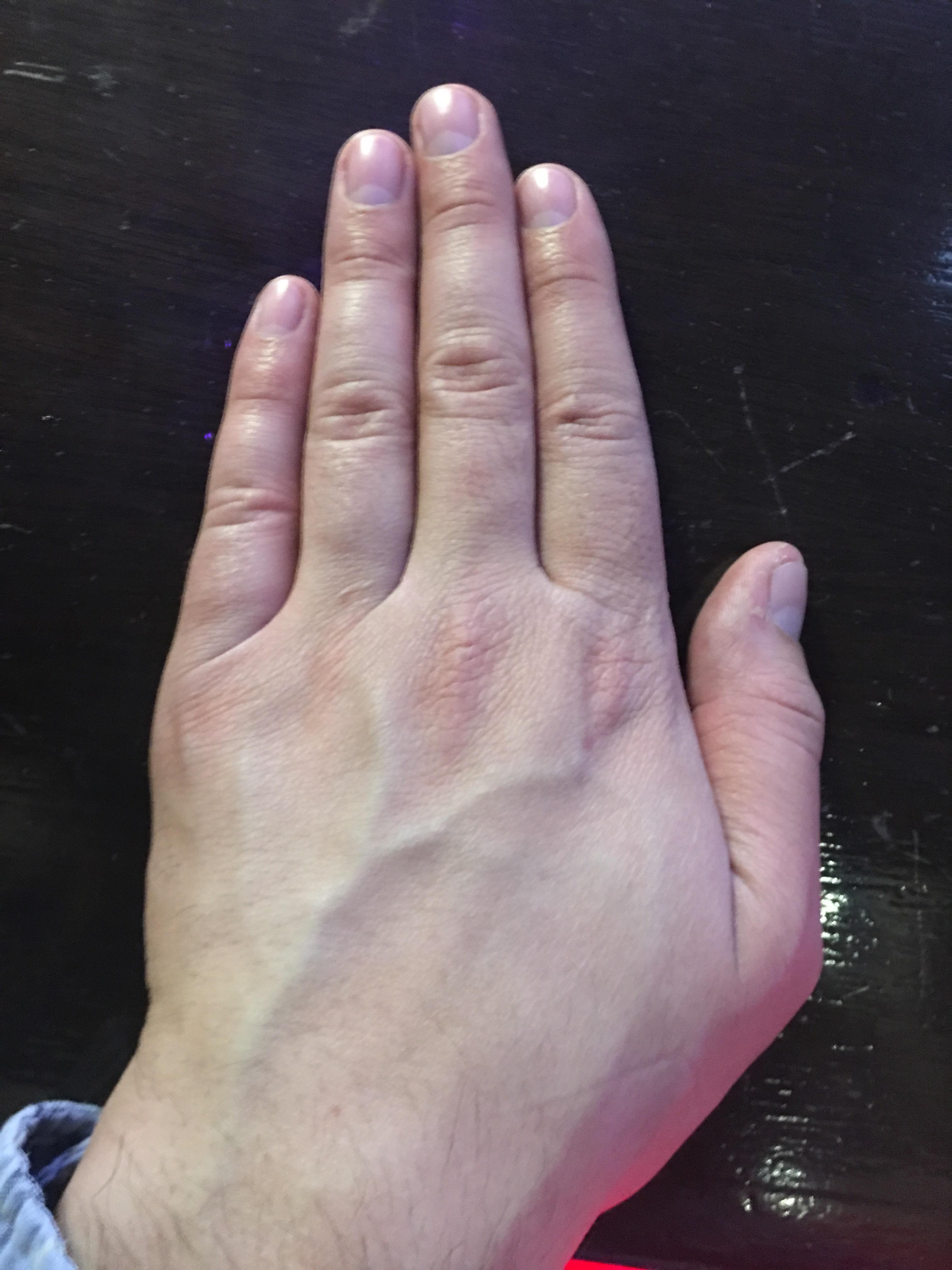 Guys Ring Finger Is Longer Than Index at Ralph Hutchinson blog
