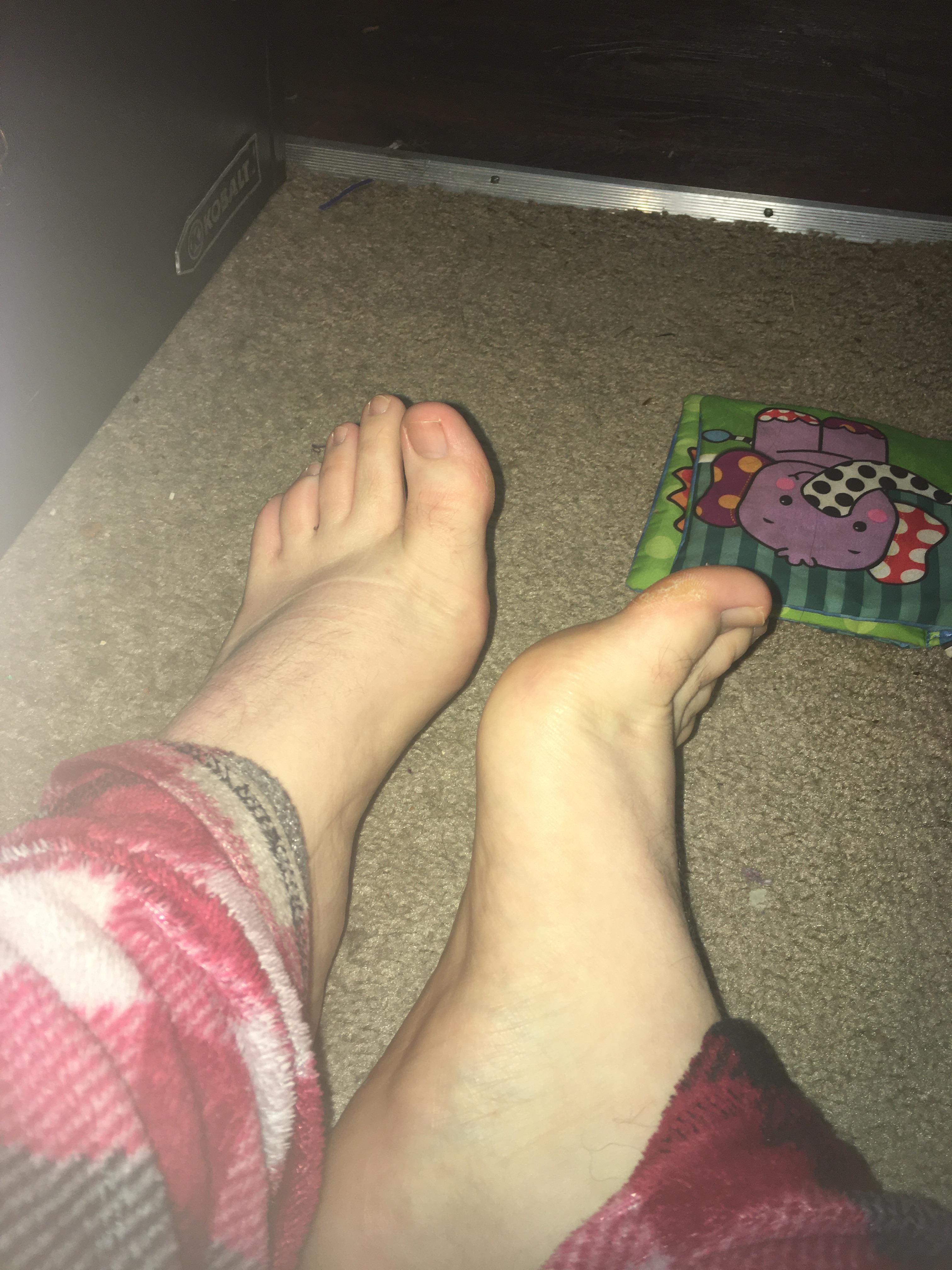 Rate my feet. 1/10 r/Rate_my_feet
