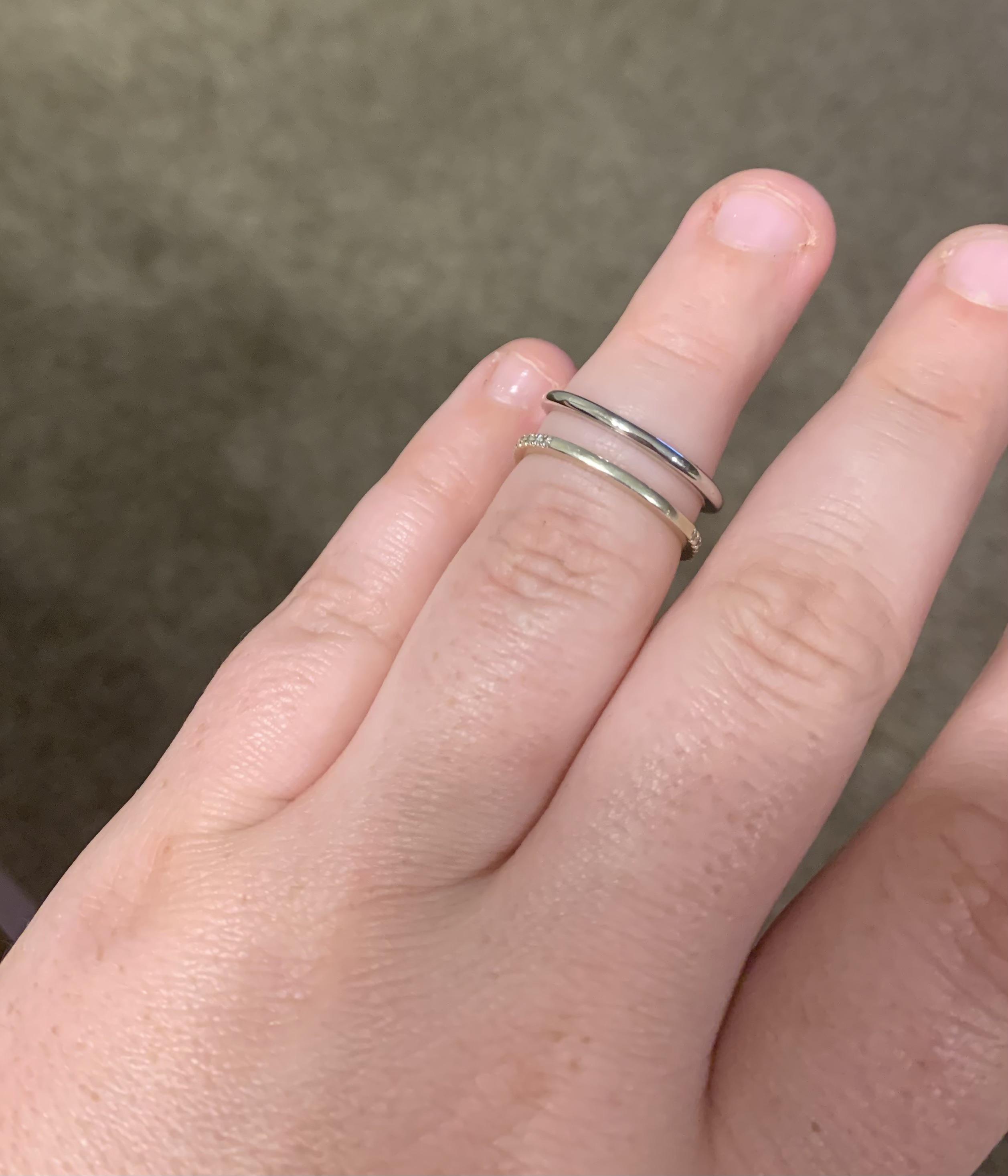 Does white gold or yellow gold look better on my skin? r/EngagementRings