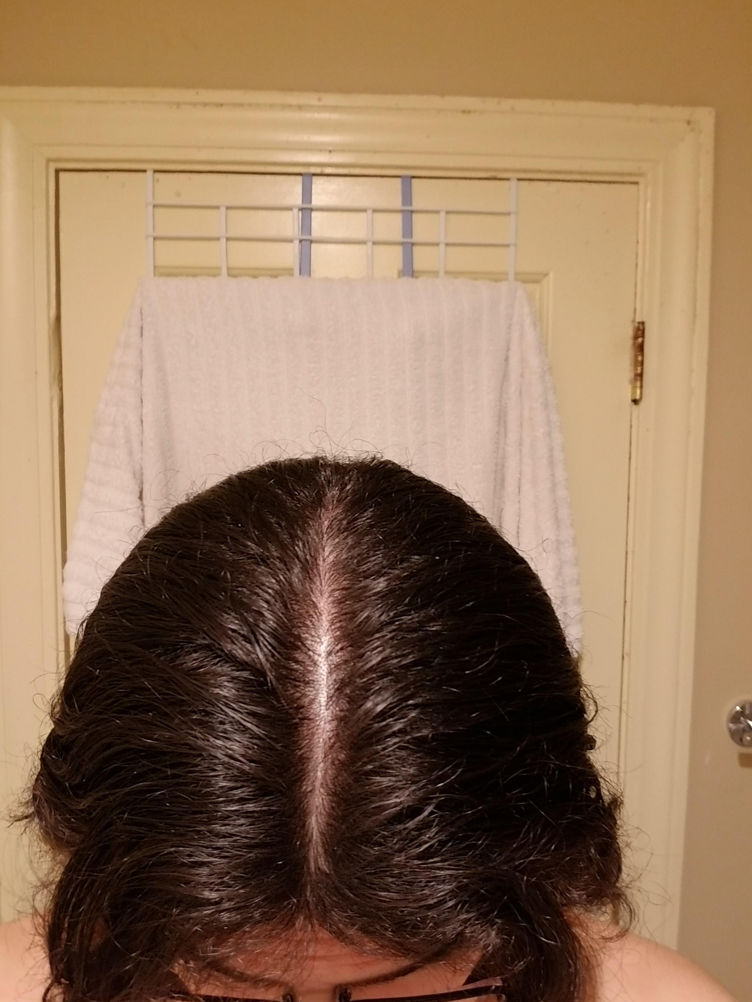 Hi friends, is my hair thinning? I feel like my hair part is too wide