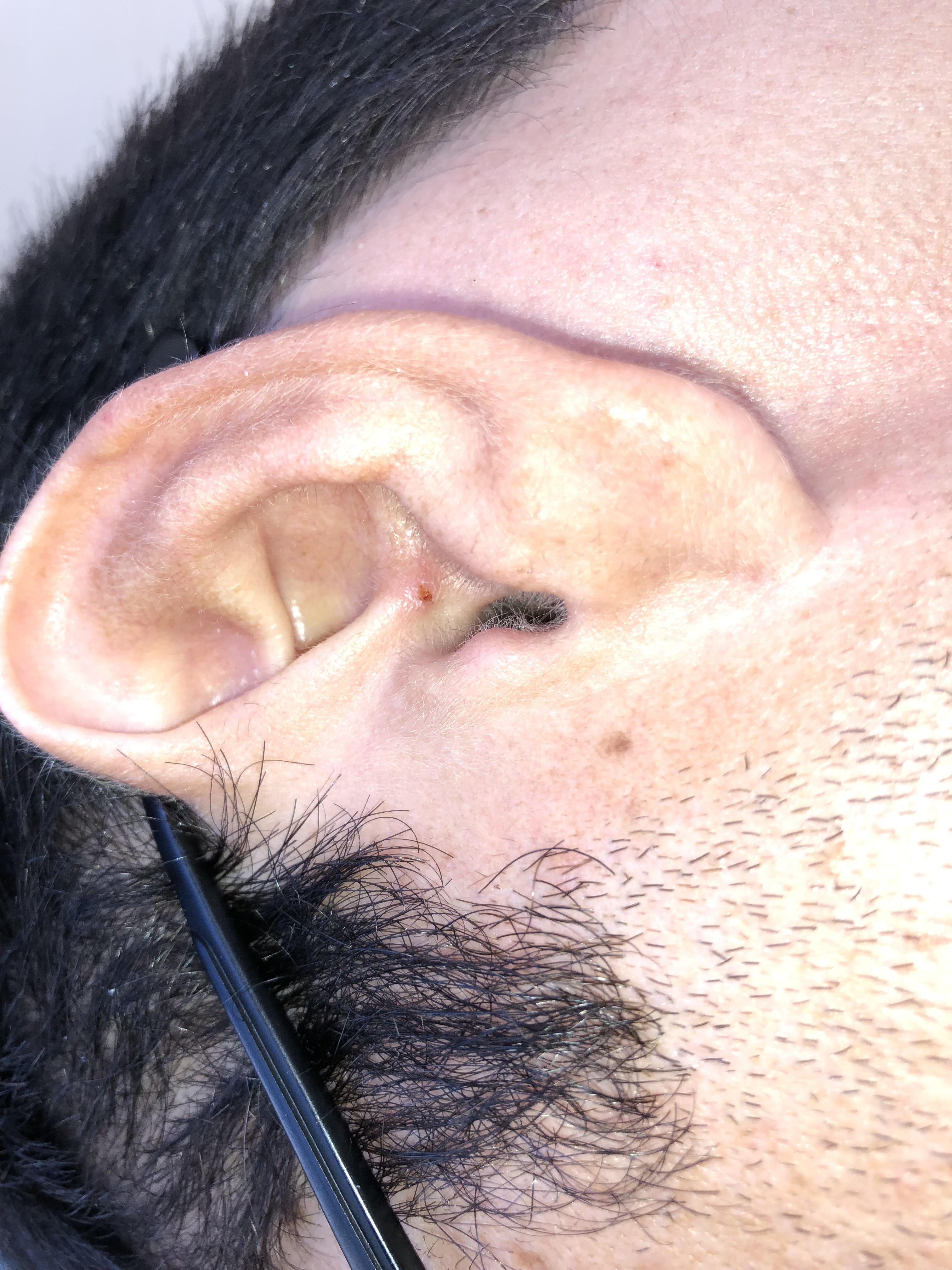 Thanks apple airpods for hurting my ears. r/airpods