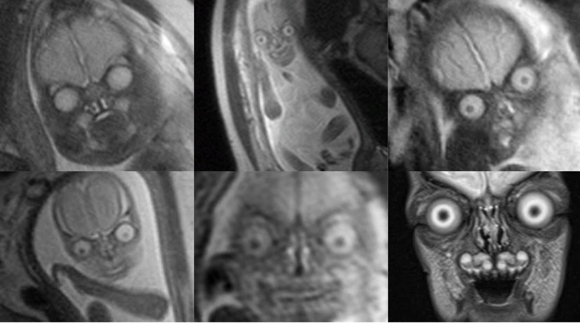 MRI scans of babies in the womb r/oddlyterrifying