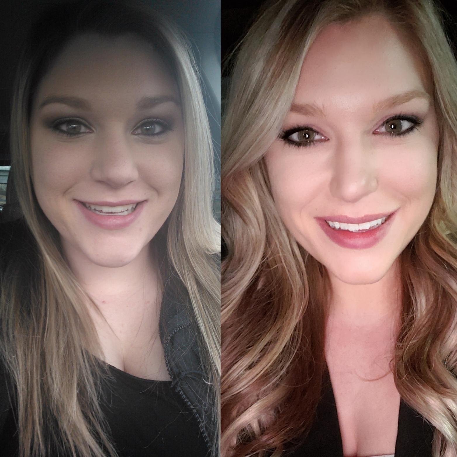 F/27/5'7 [210lbs >159lbs = 51lbs] face gains, carb face vs keto face
