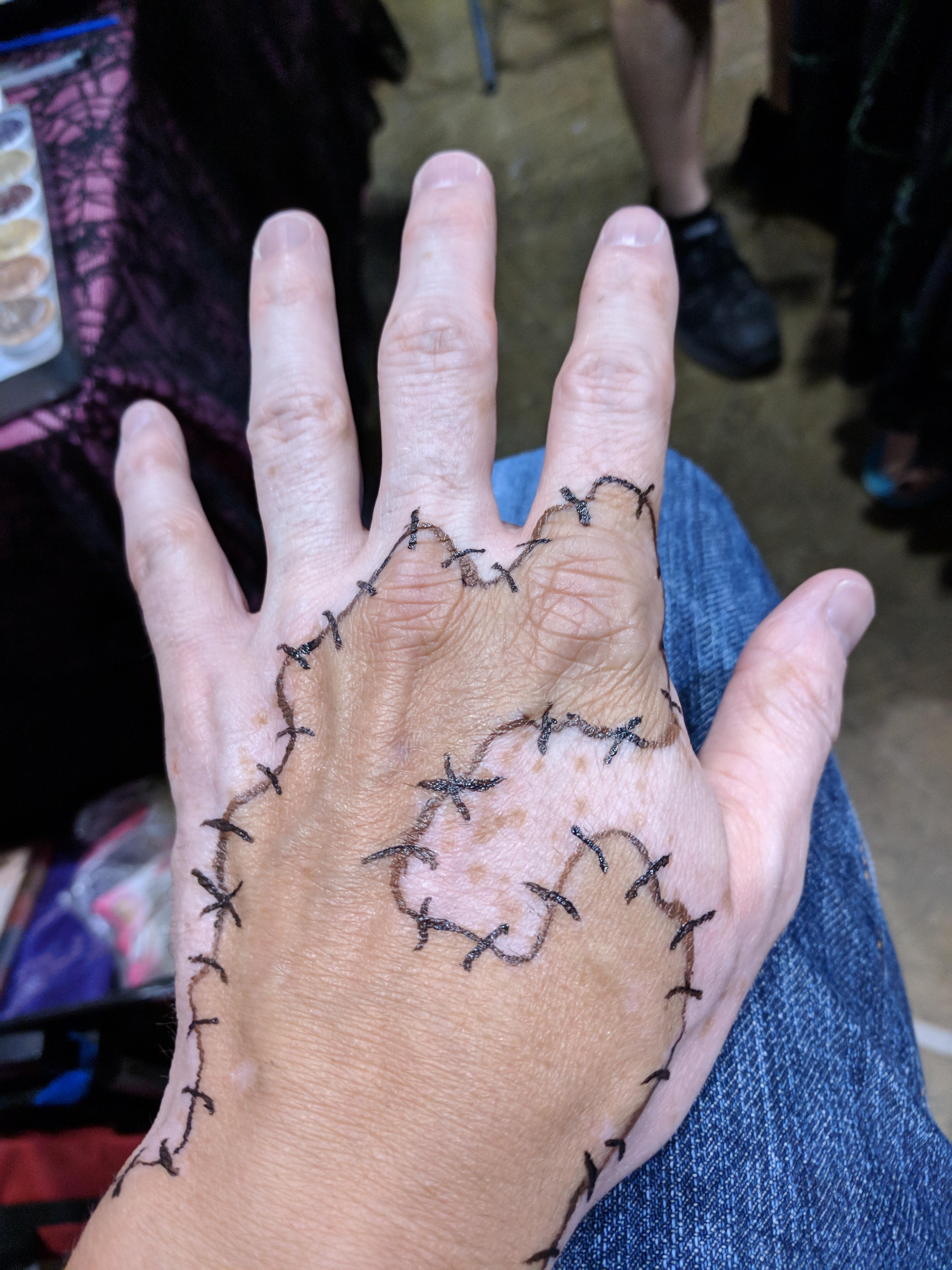 I used to have solid continuous shapes, now I get confetti r/Vitiligo