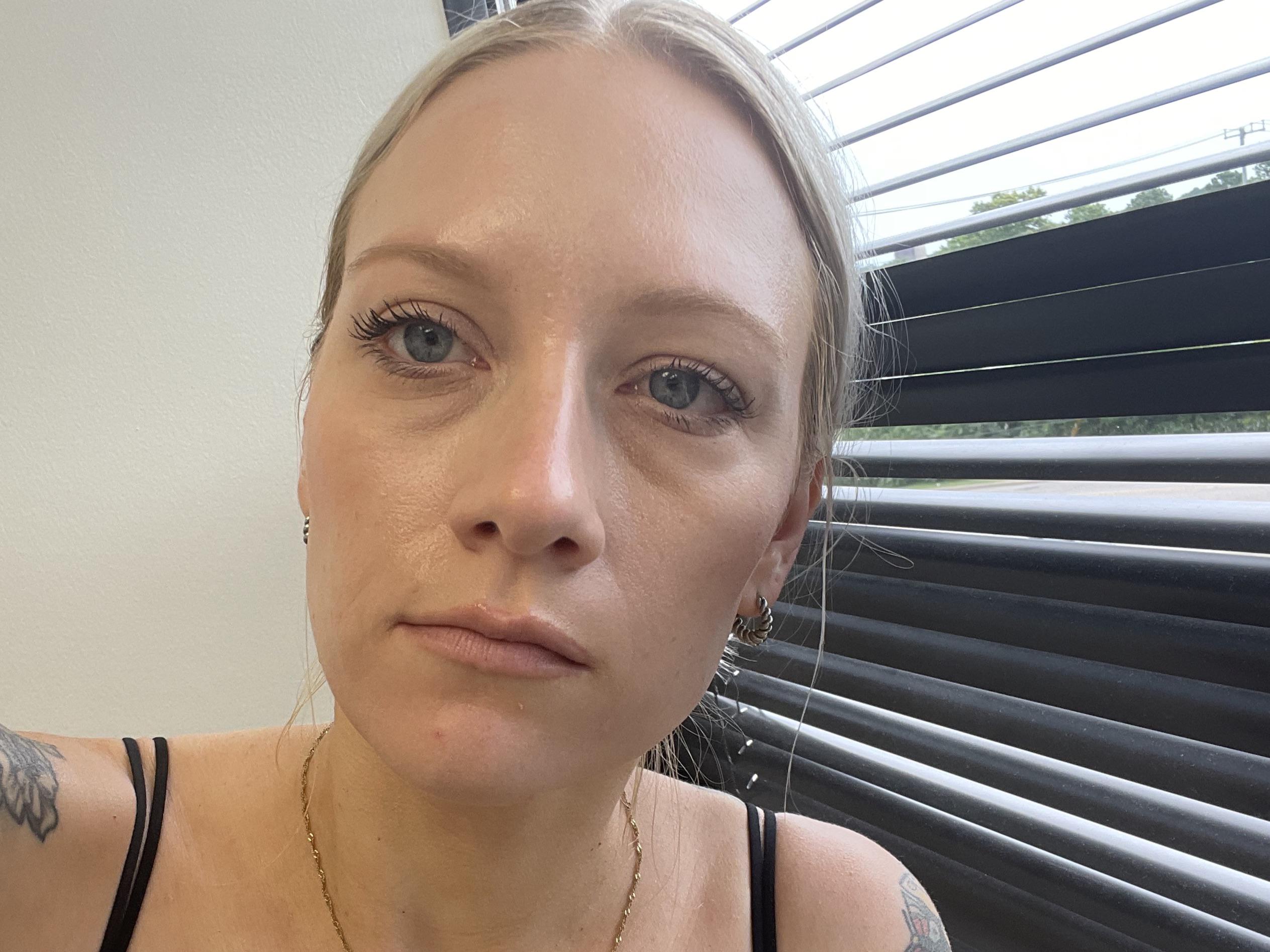 Dark circles ruin my face r/30PlusSkinCare