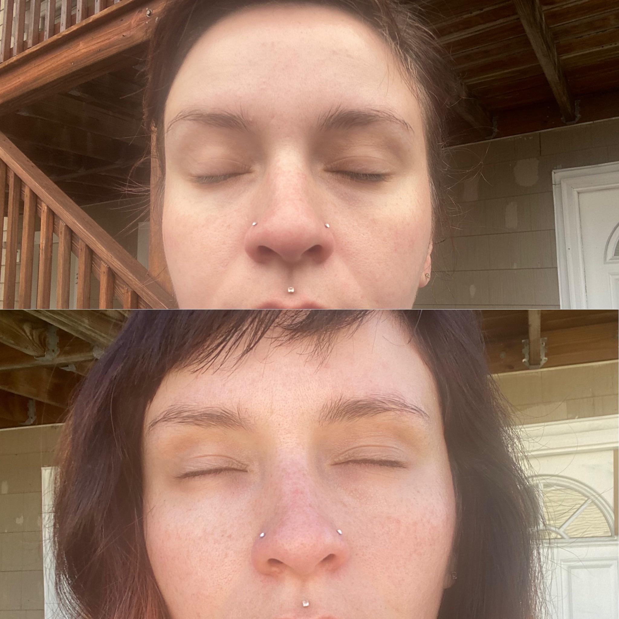Cigarettes Before And After Face