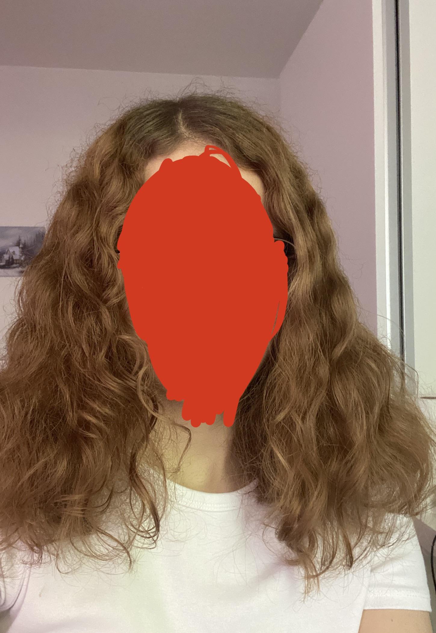 Can someone tell me what’s wrong with my hair? It’s my biggest