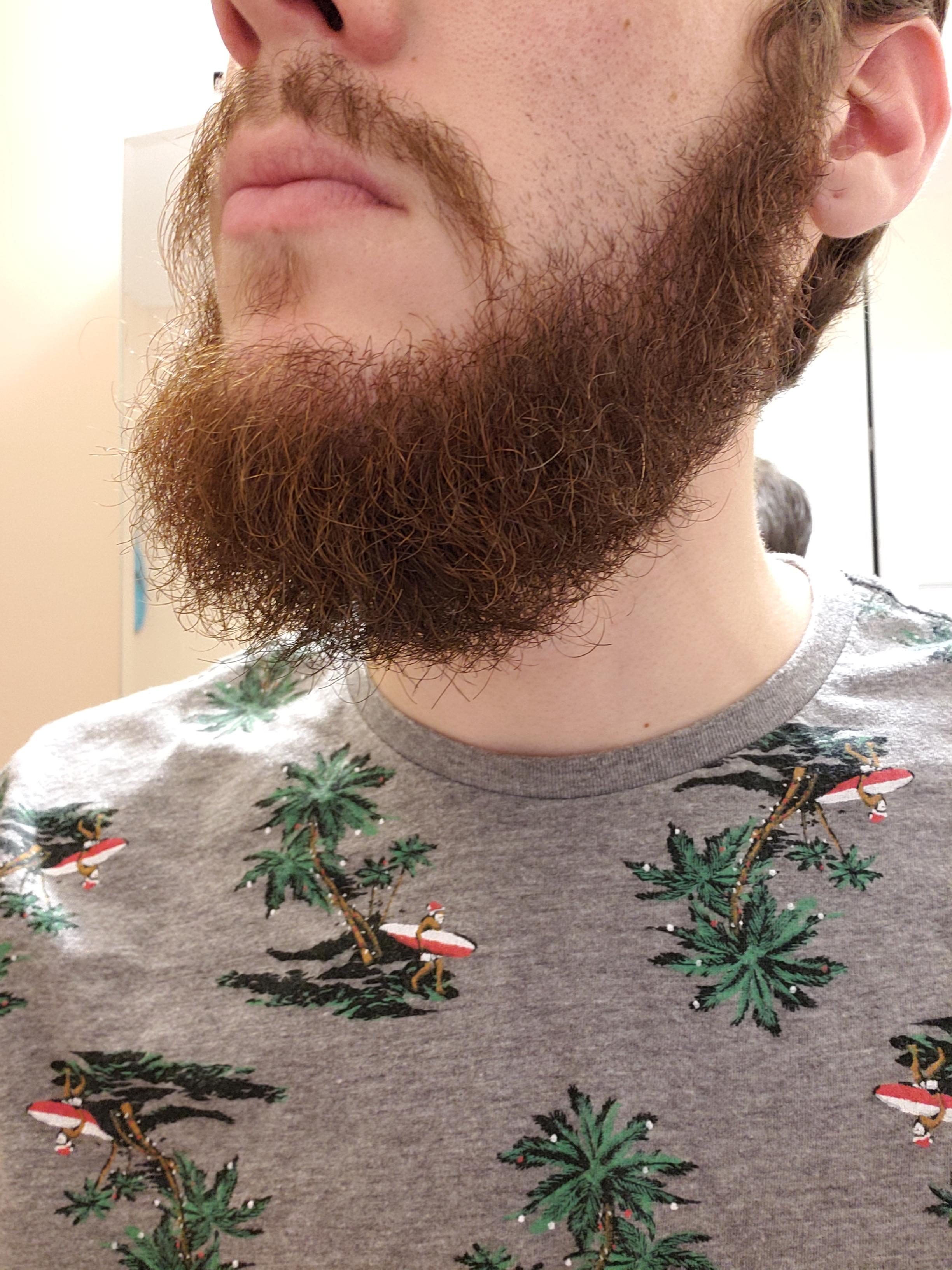 Working on about 45 months. Should I keep going? Mustache and under