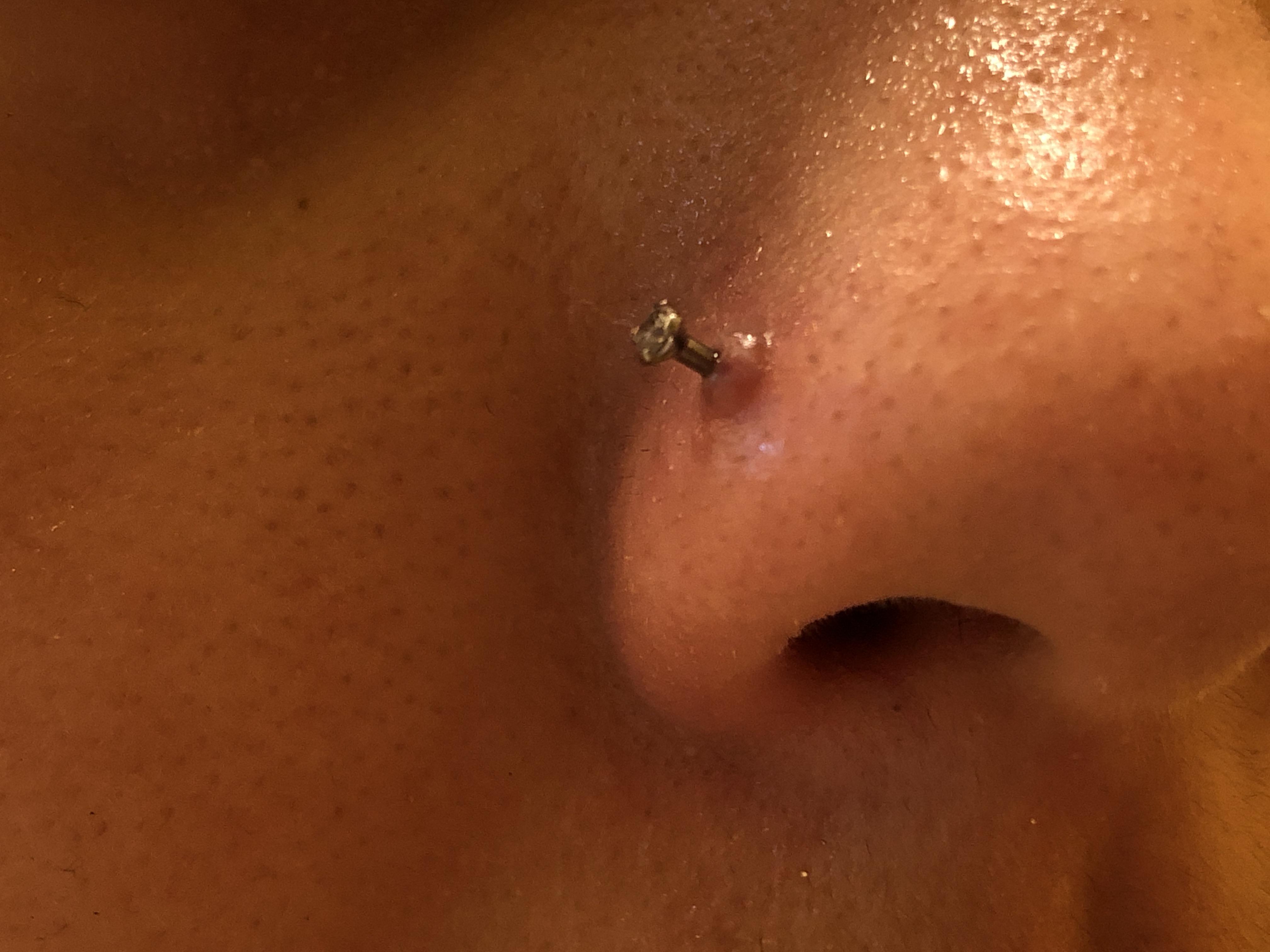 Nose Piercing Bump HELP!! Is it a keloid? My piercing is under 2 mths