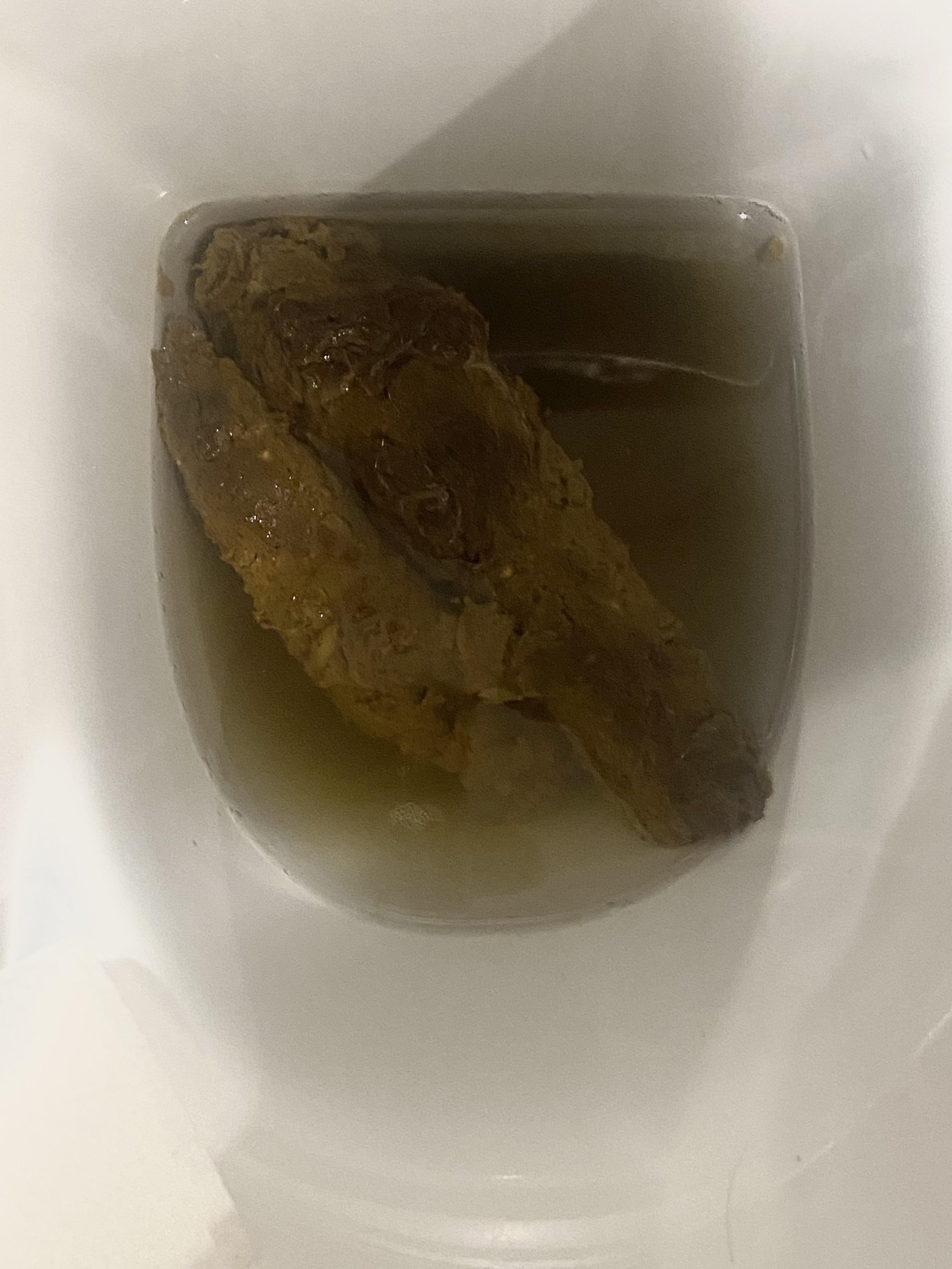 Is this stool normal??? I frequently have these ones 😥 r/poop