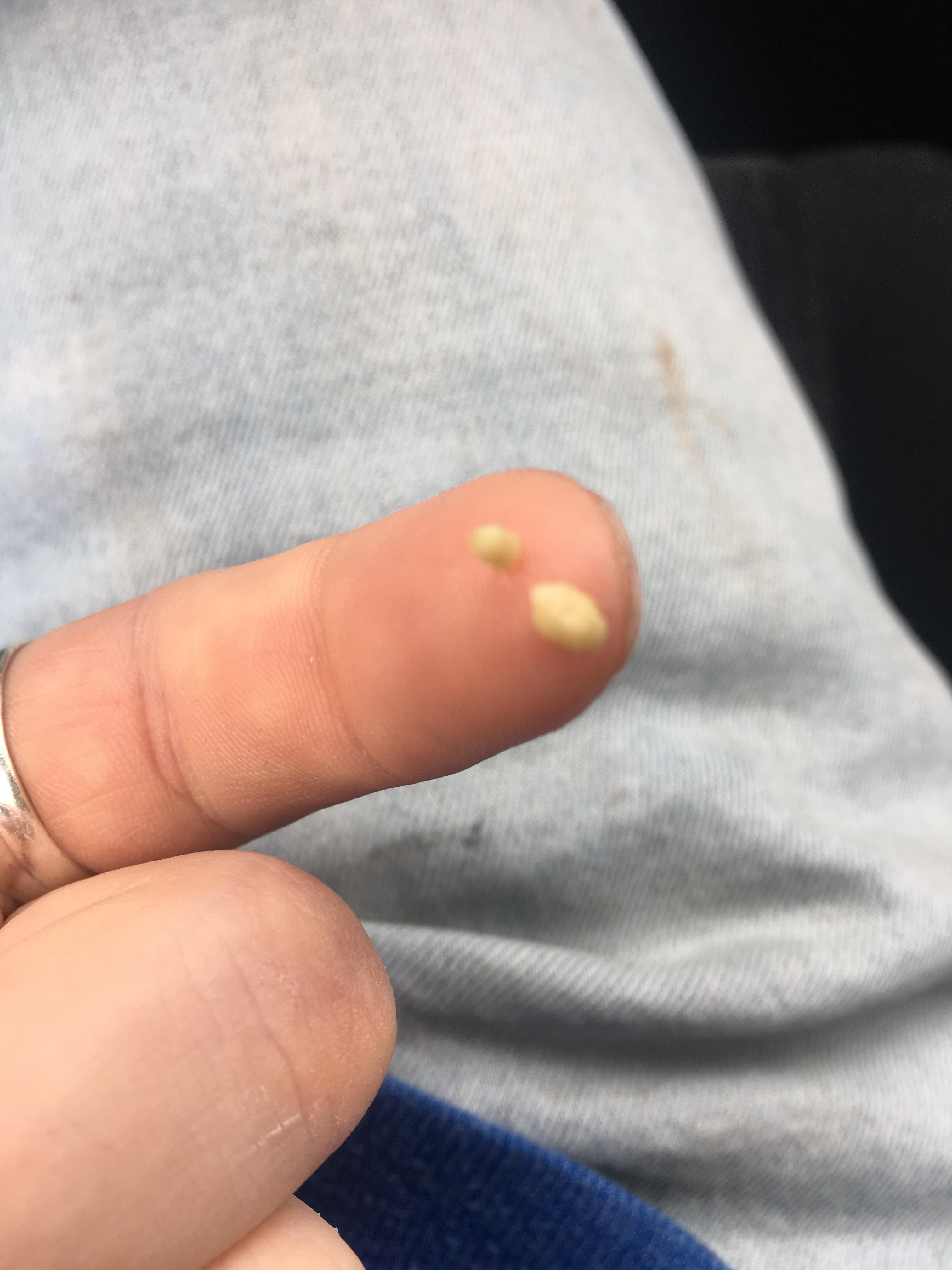 Man these things really do smell like death popping