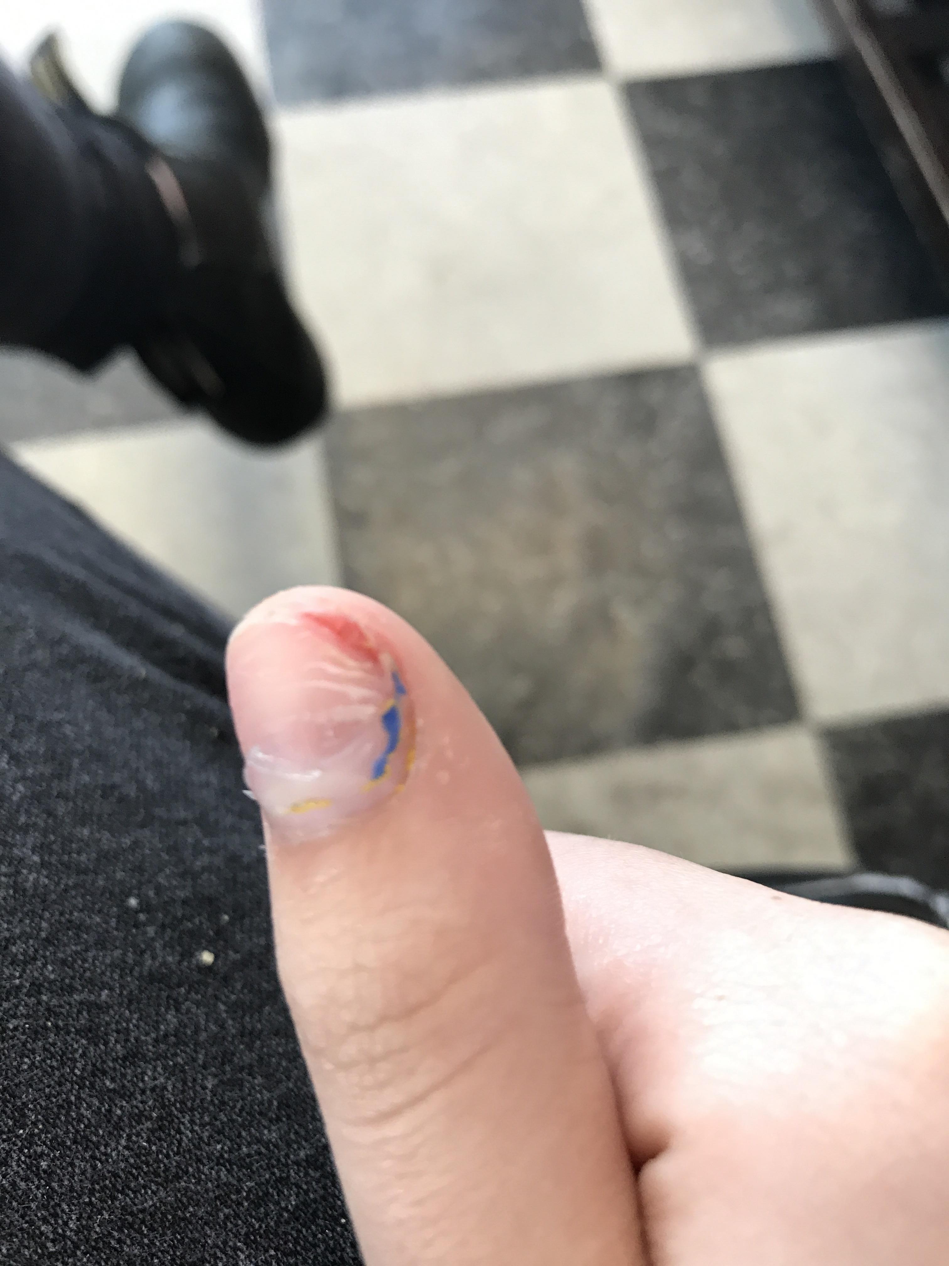 Be careful when removing acrylics at home Nails