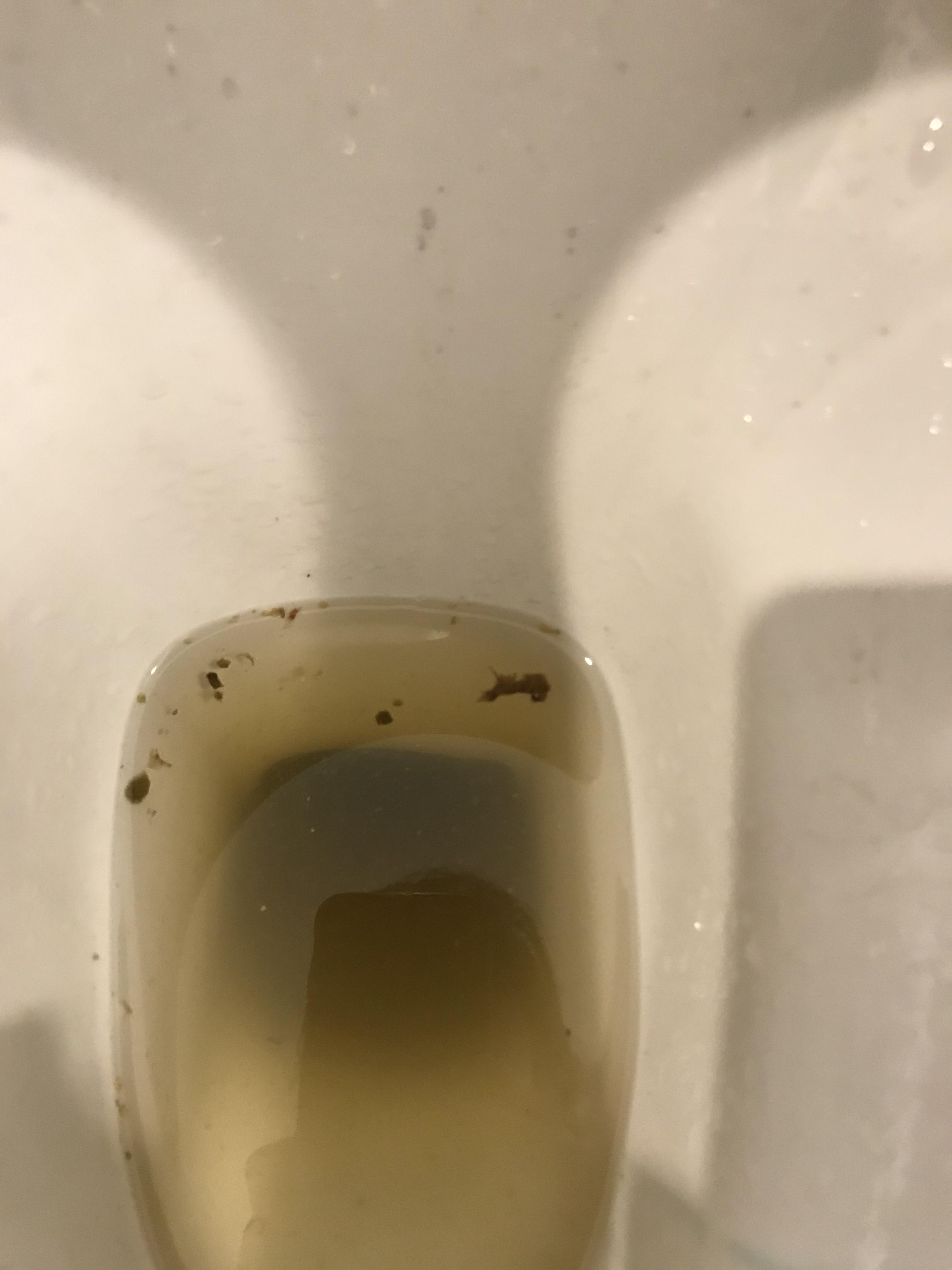 Why does my urine look like this? r/DiagnoseMe