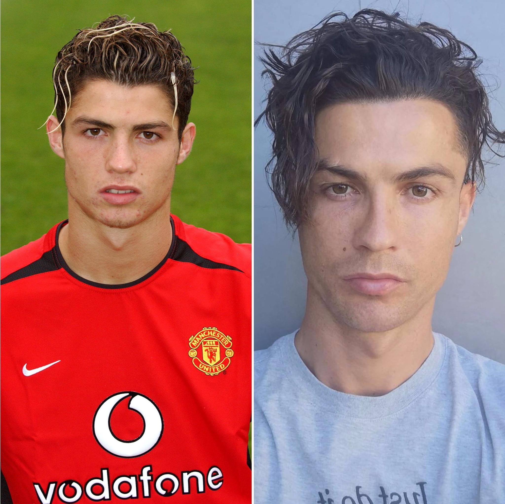 Cristiano Ronaldo’s hair transplant. r/tressless
