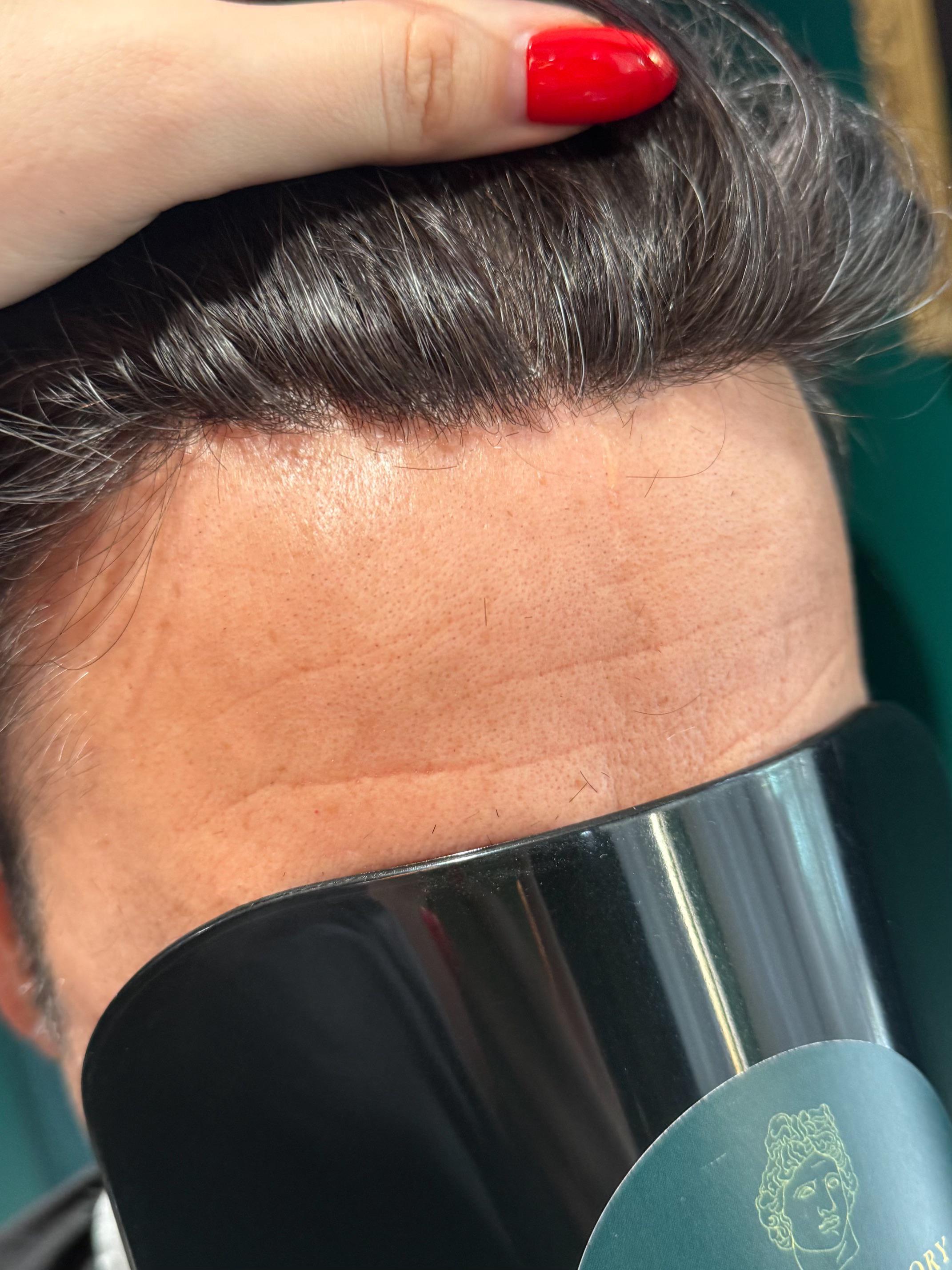 Hair line reveal! r/HairSystem(01)