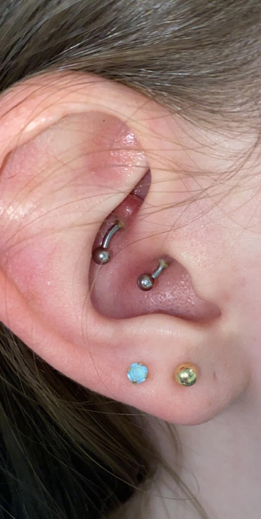 Help on how to heal daith bump, 3 month old piercing (gross sorry