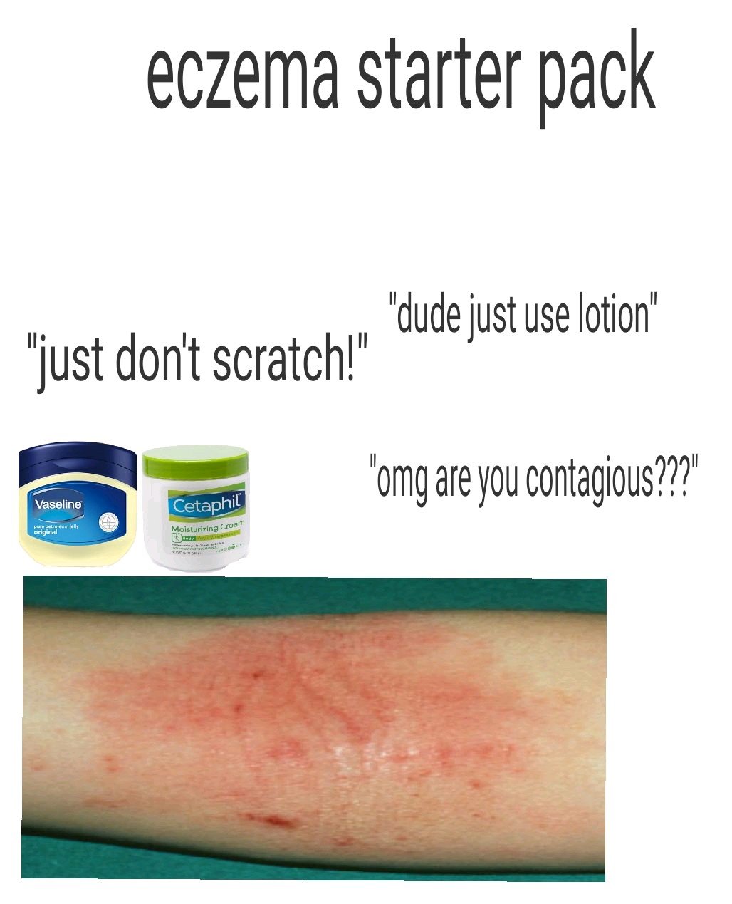 overview for gigglingtomato