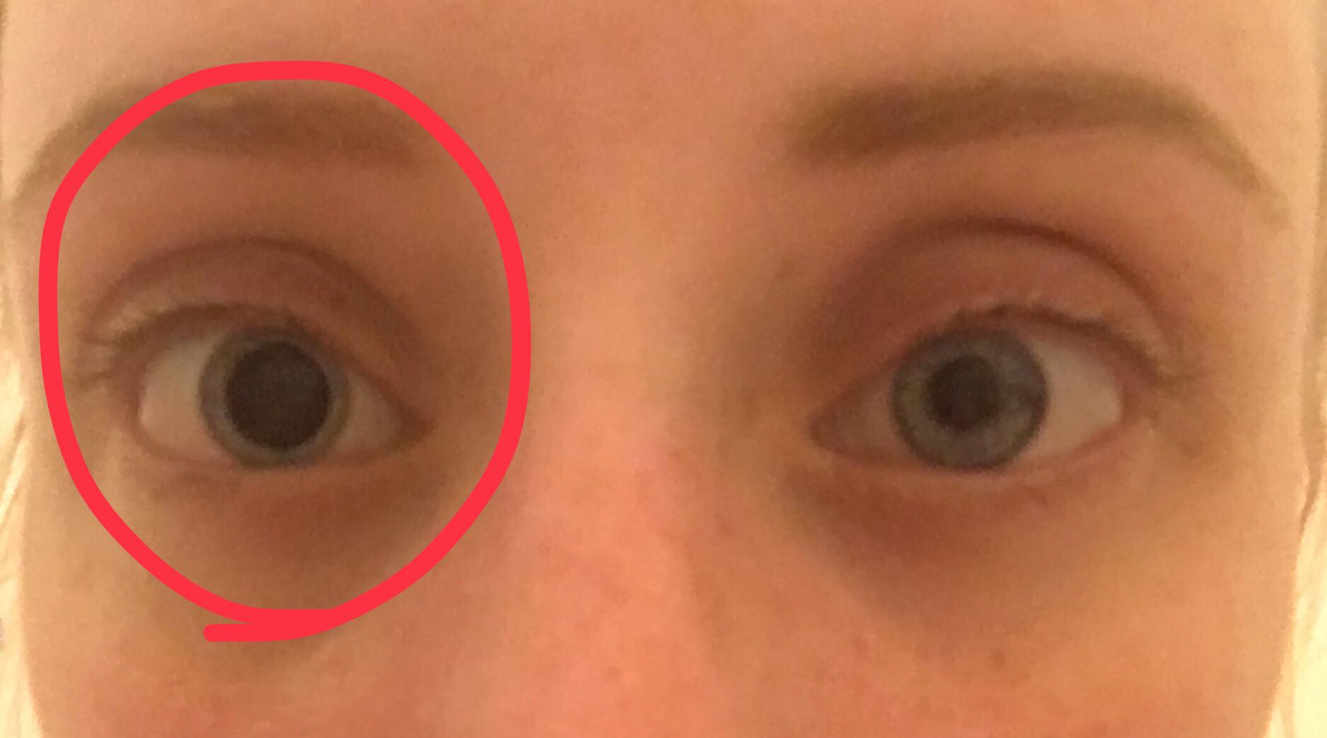 Just wondering what’s going on here. I used some allergy relief eye