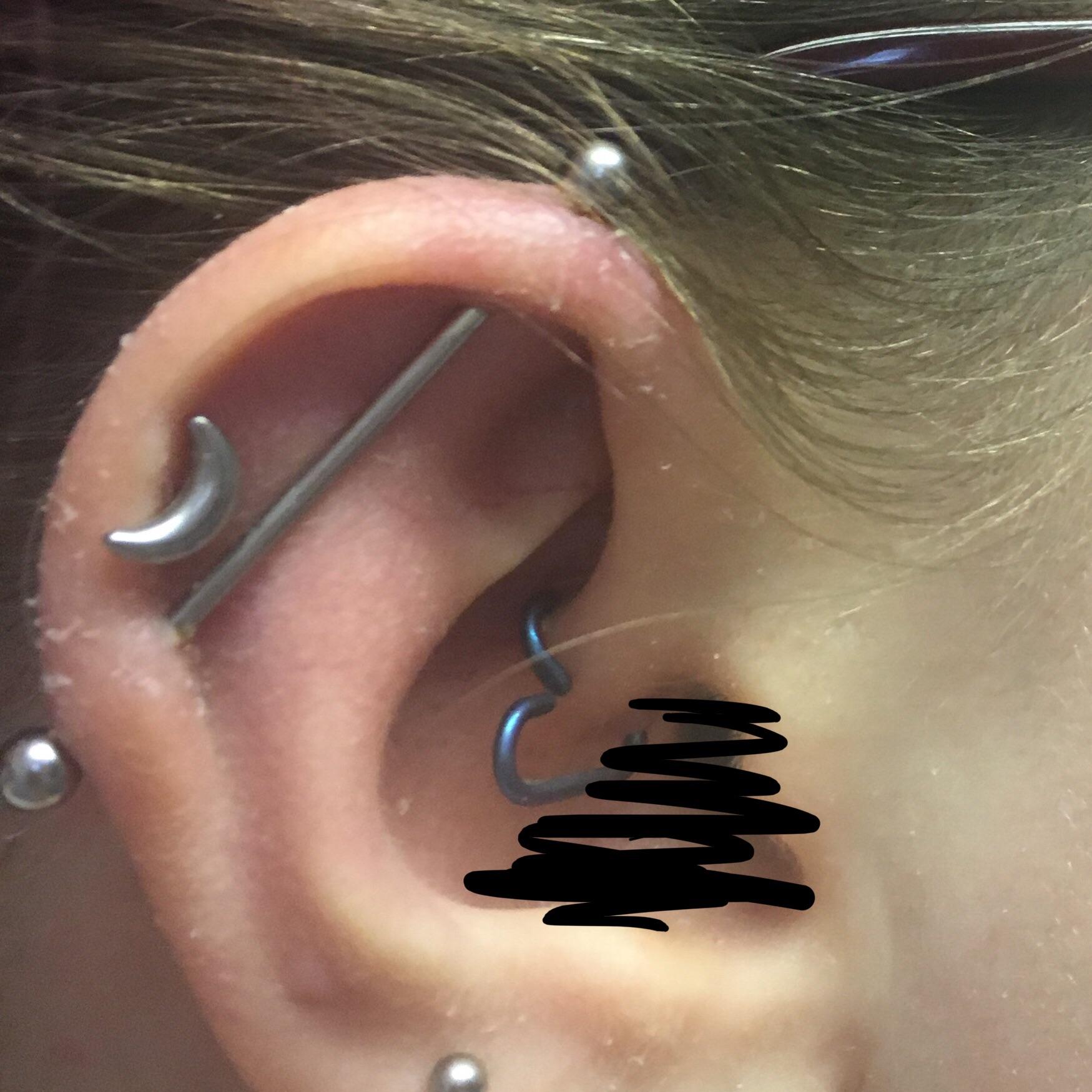 Industrial suddenly like this and itchy? piercing