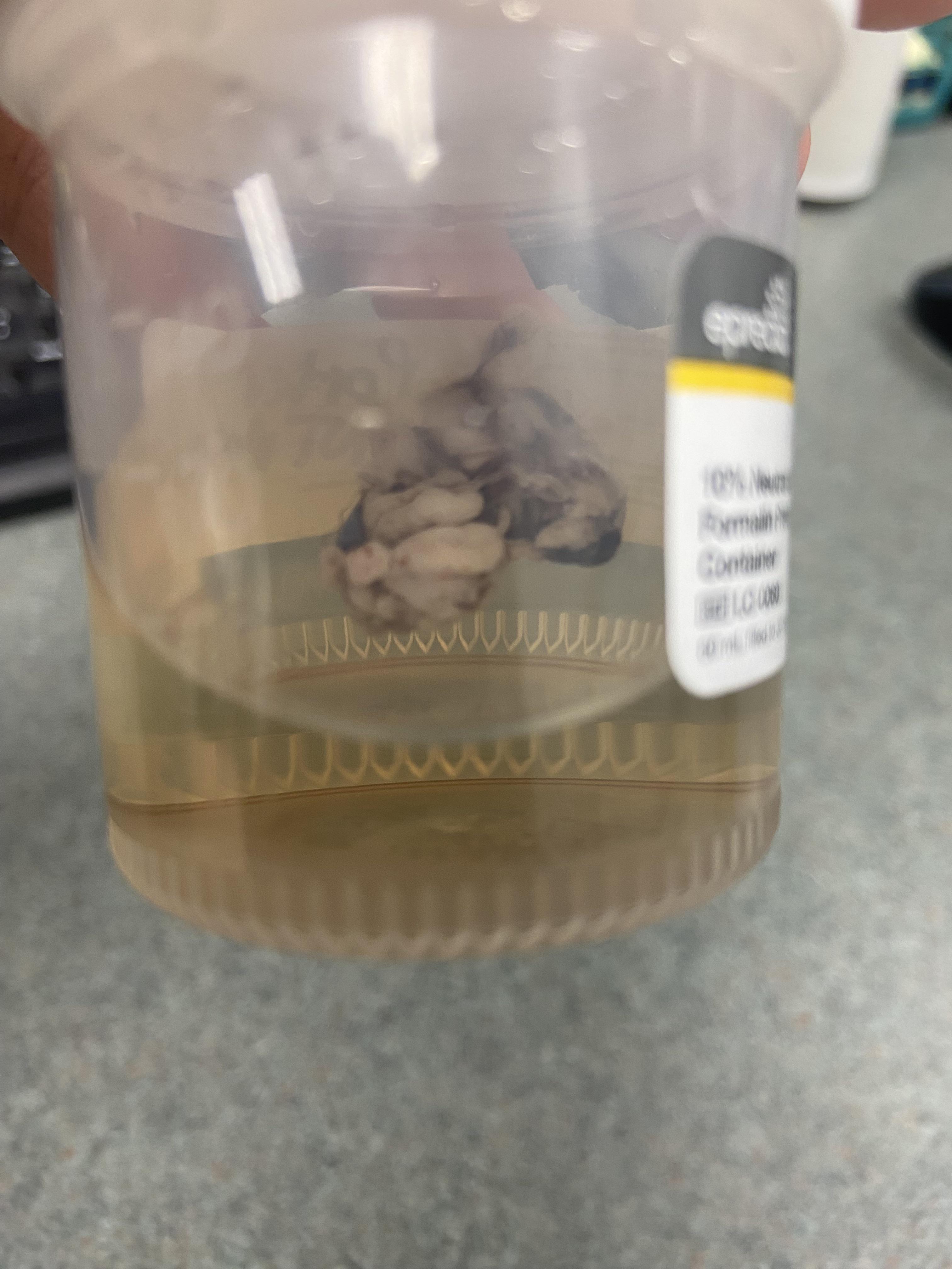 Testicle from abdominal cryptorchid neuter r/VetTech