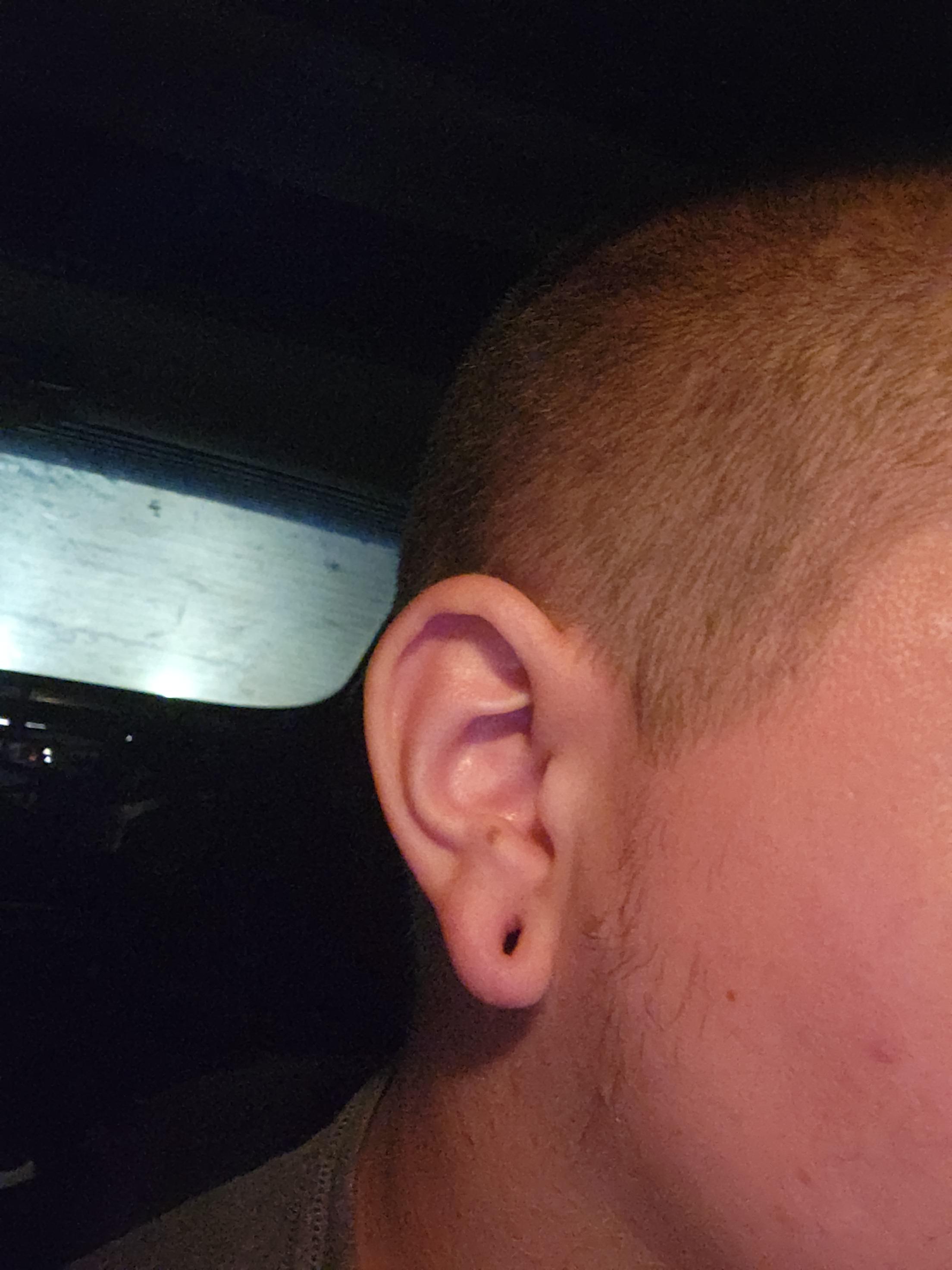 my ears are 3/4 and this is what happens when I sleep without jewelry