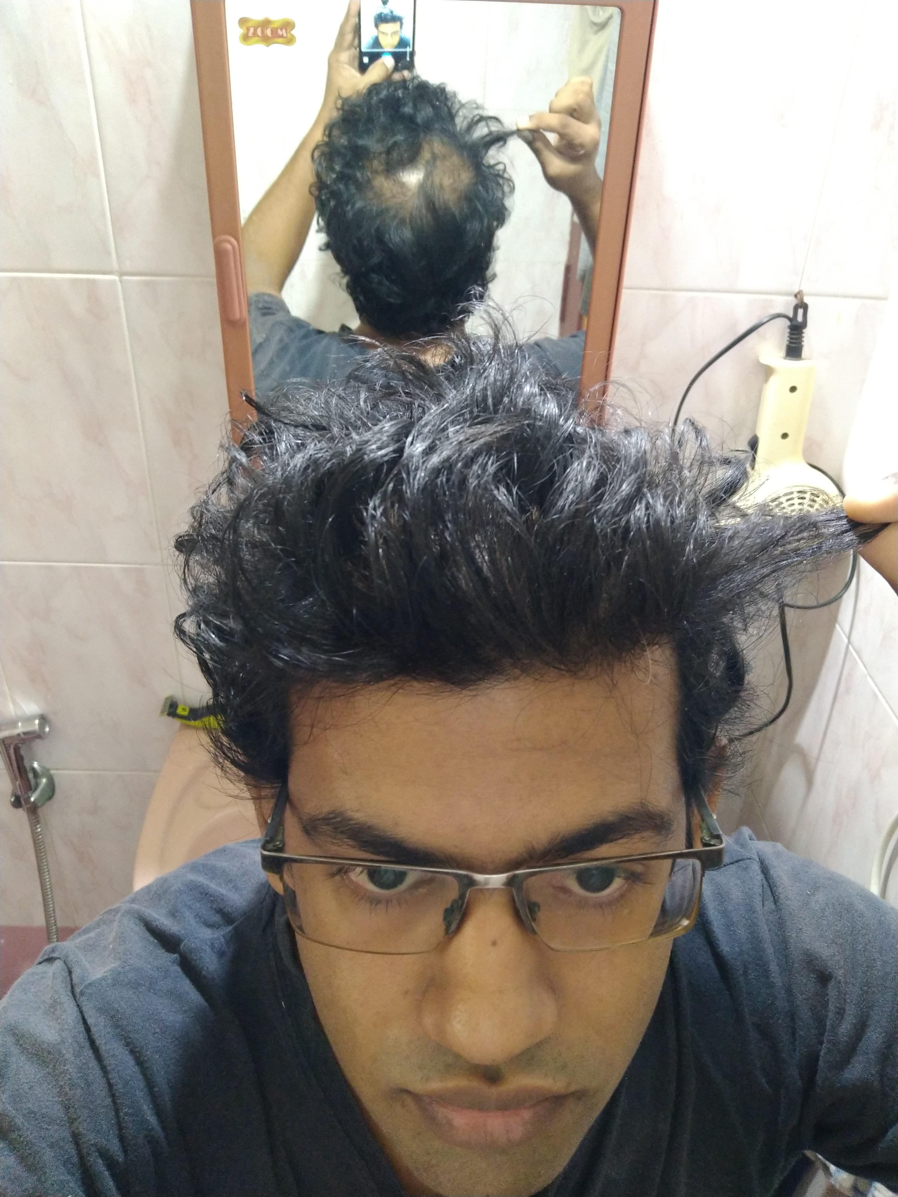 31M Indian, thinning hair on top. I've usually gone for a buzz cut for