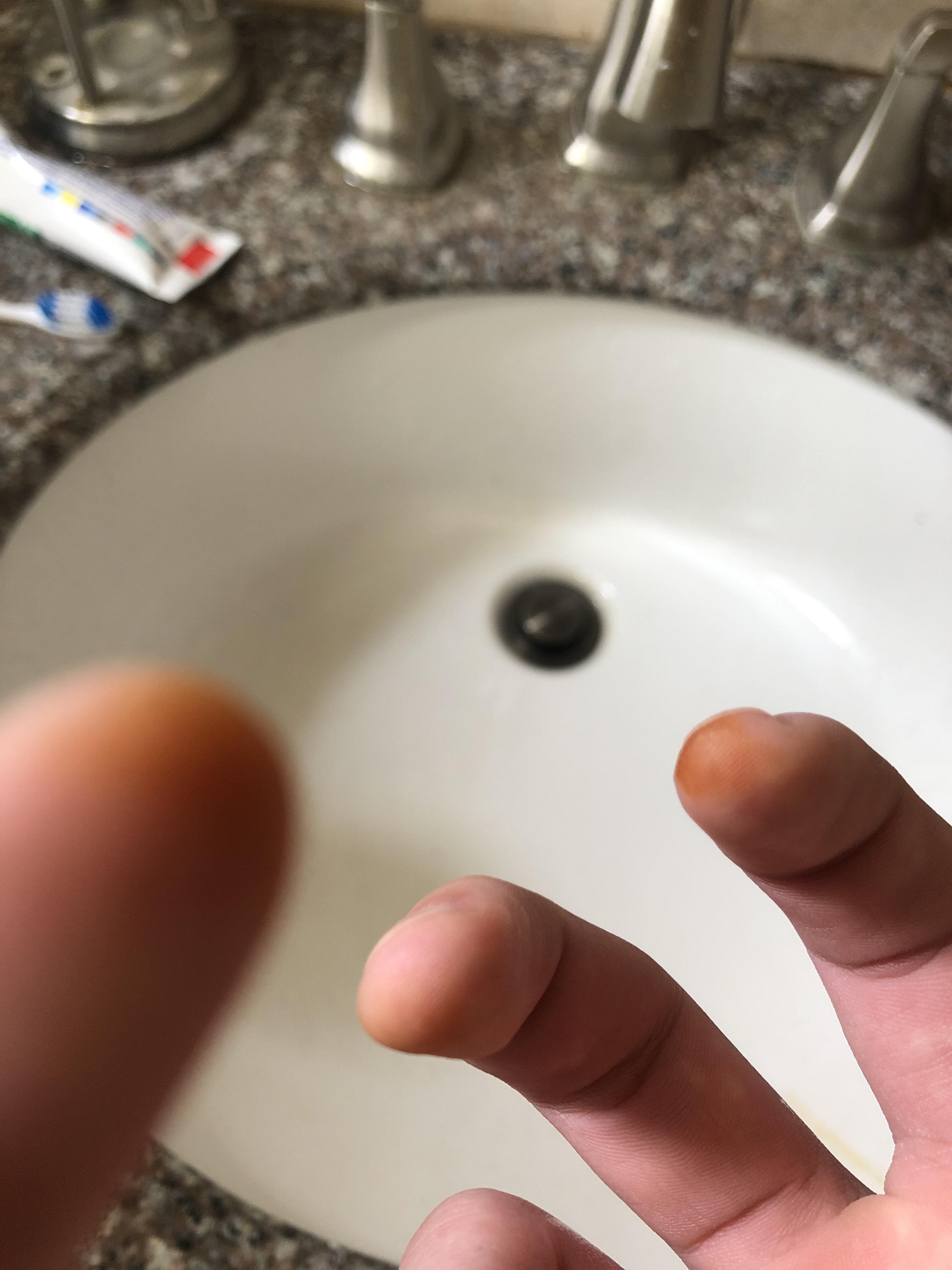 I noticed these yellow fingertips when washing my hands. r/medical