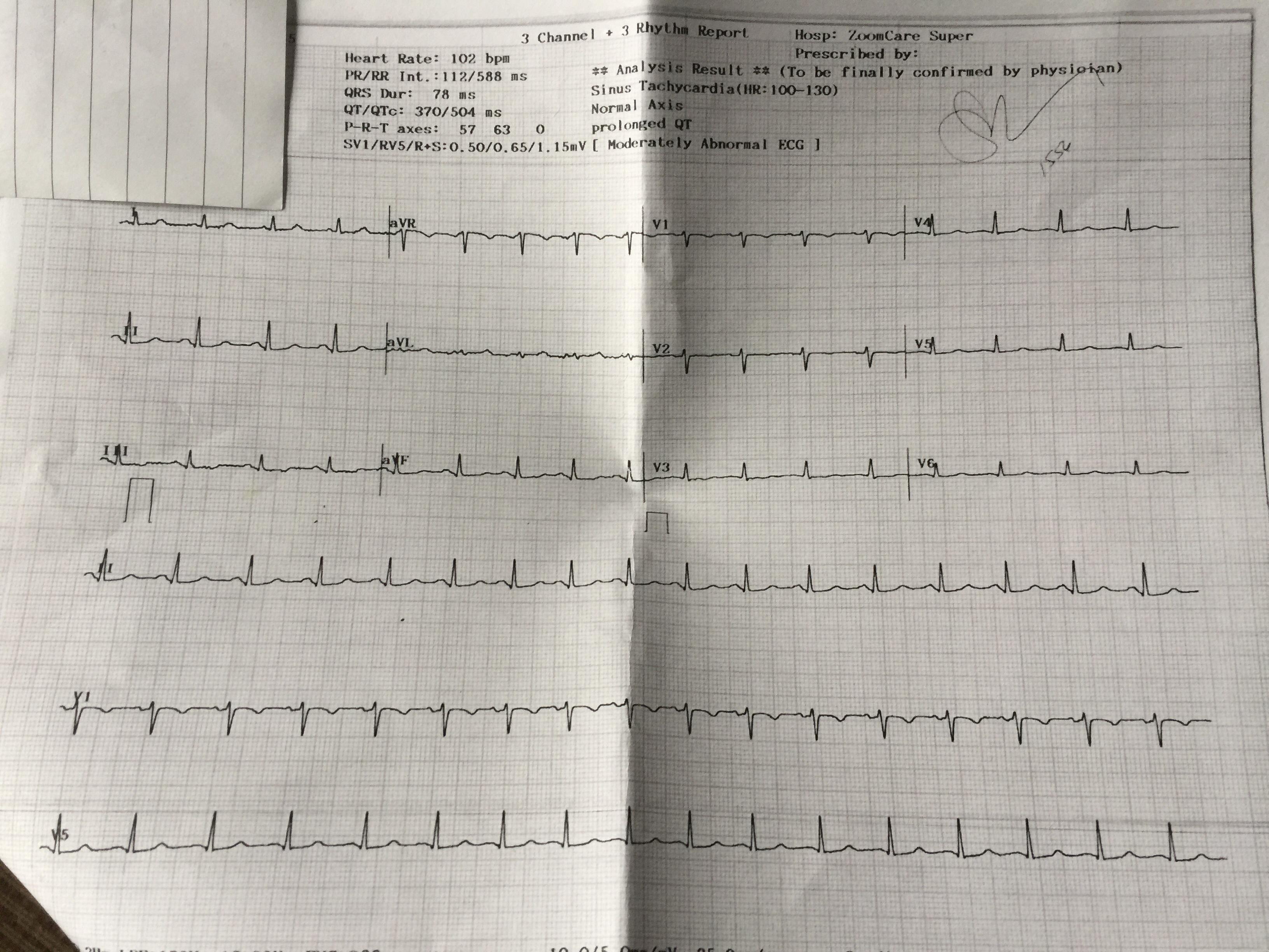 Prolonged QT at 504 with tachycardia (up to 175bmp) and chest pains