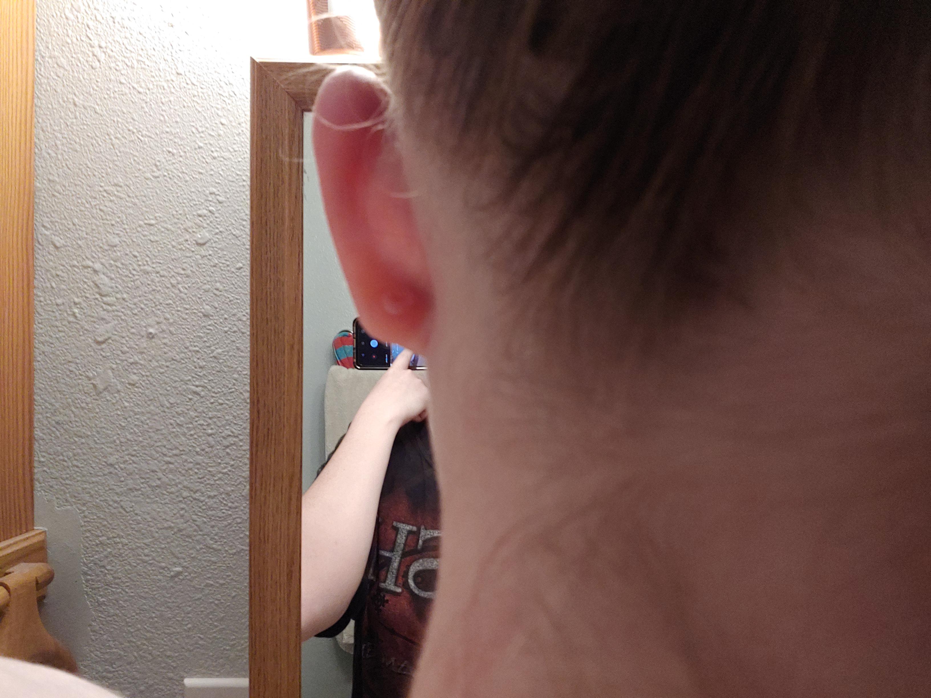 Letting my ears shrink down and restretching to help with