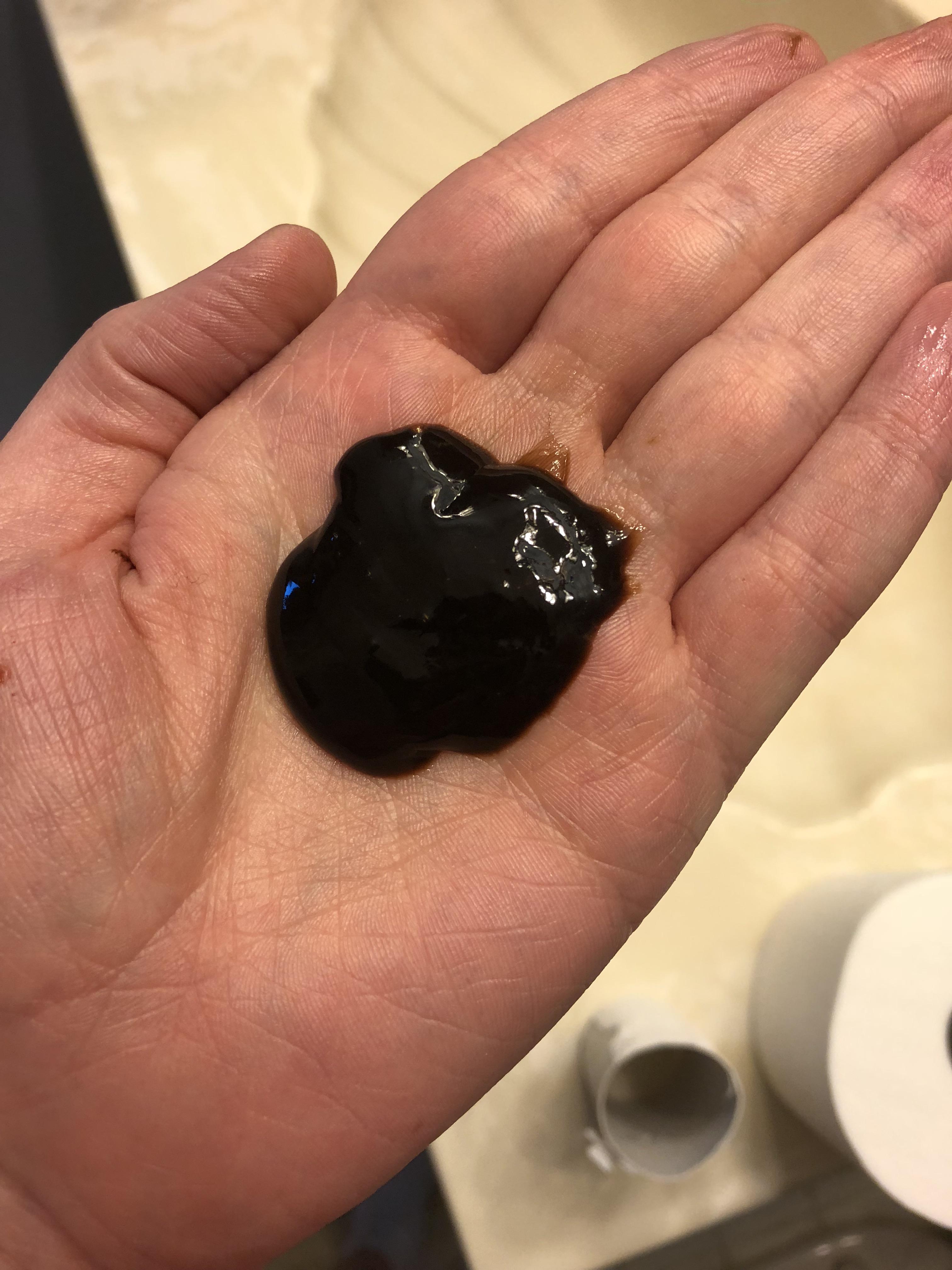 Another from 2 weeks post sinus surgery I guess my nosed is an oil