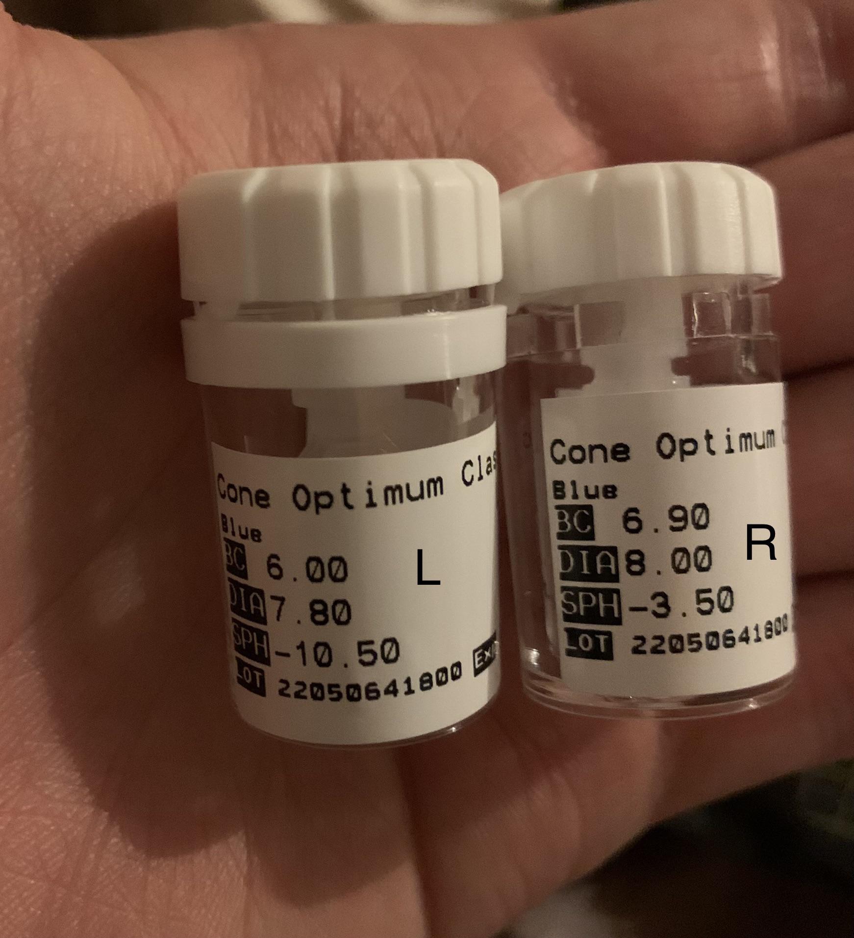 hi all right know im using rgp contact lenses for keratoconus during