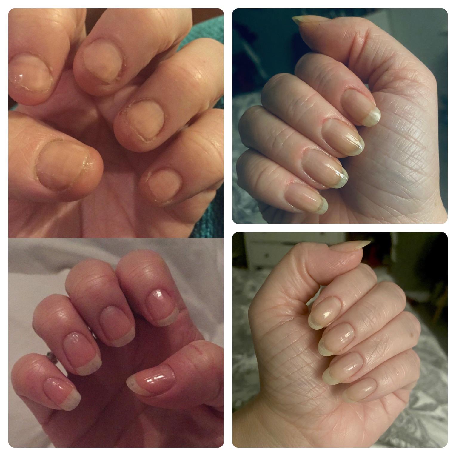 Not posted here for a few years, but having a rare nail polish free day