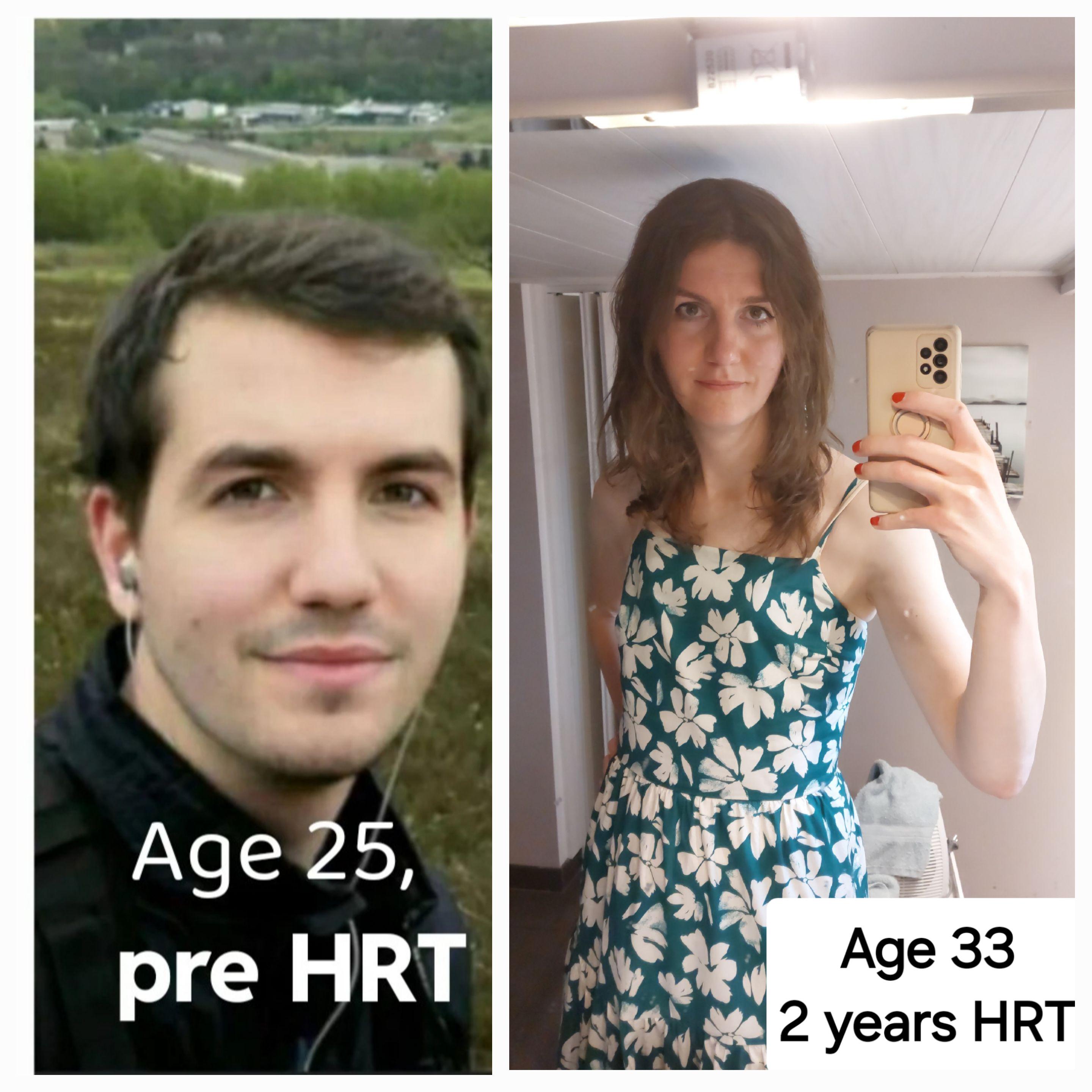 2 years of HRT ️ r/transtimelines