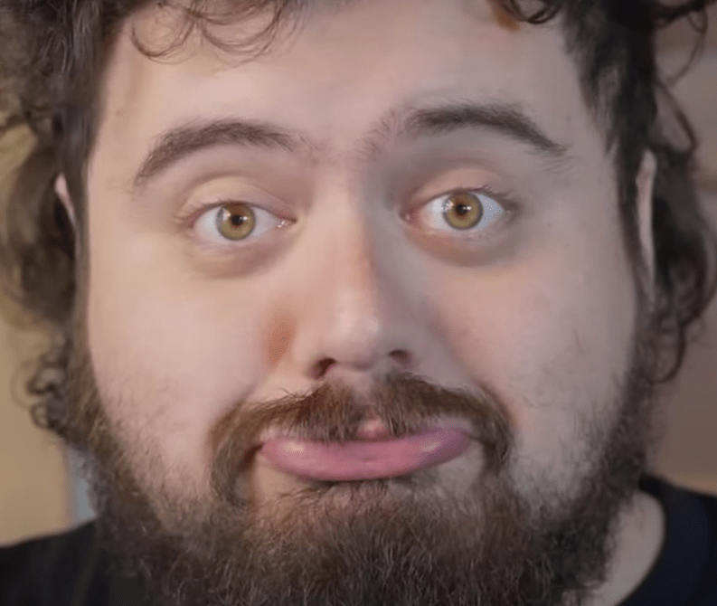 How is the color of meatcanyon's eyes called? r/MeatCanyon