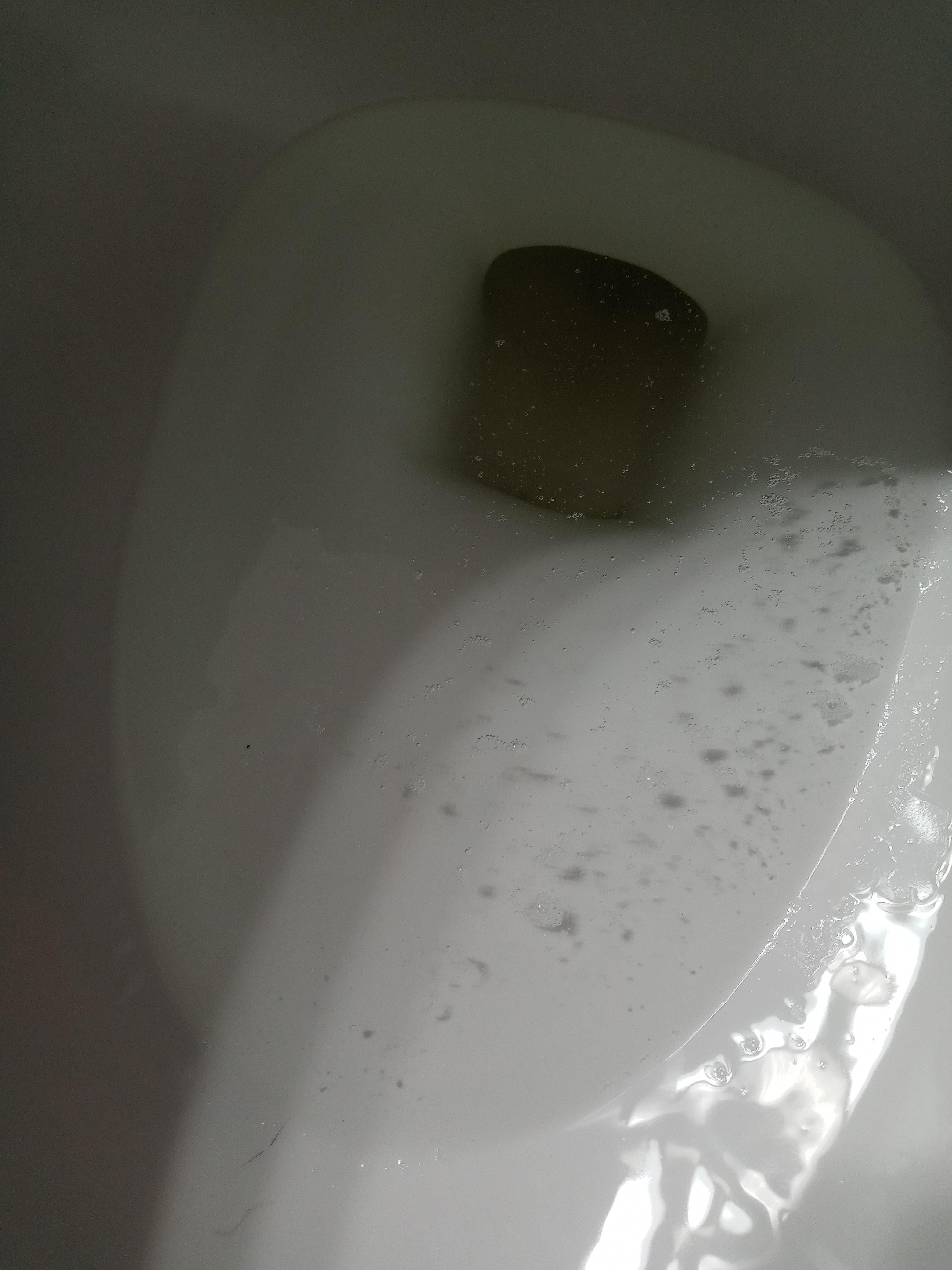 Been Having Tissue/Particles In My Urine. 22 Year Old Female Only Things I Take Are Multivitamins, Probiotics. Ive Been Having These Floating Clumps/ Particles In My Urine For Quite Awhile. Doctors Have Found