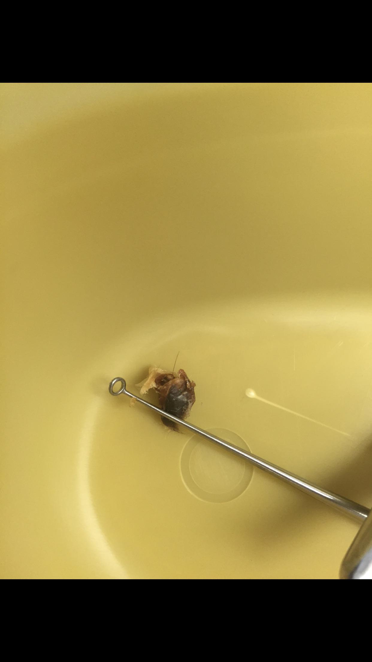 My husband’s doctor was checking his ears and then