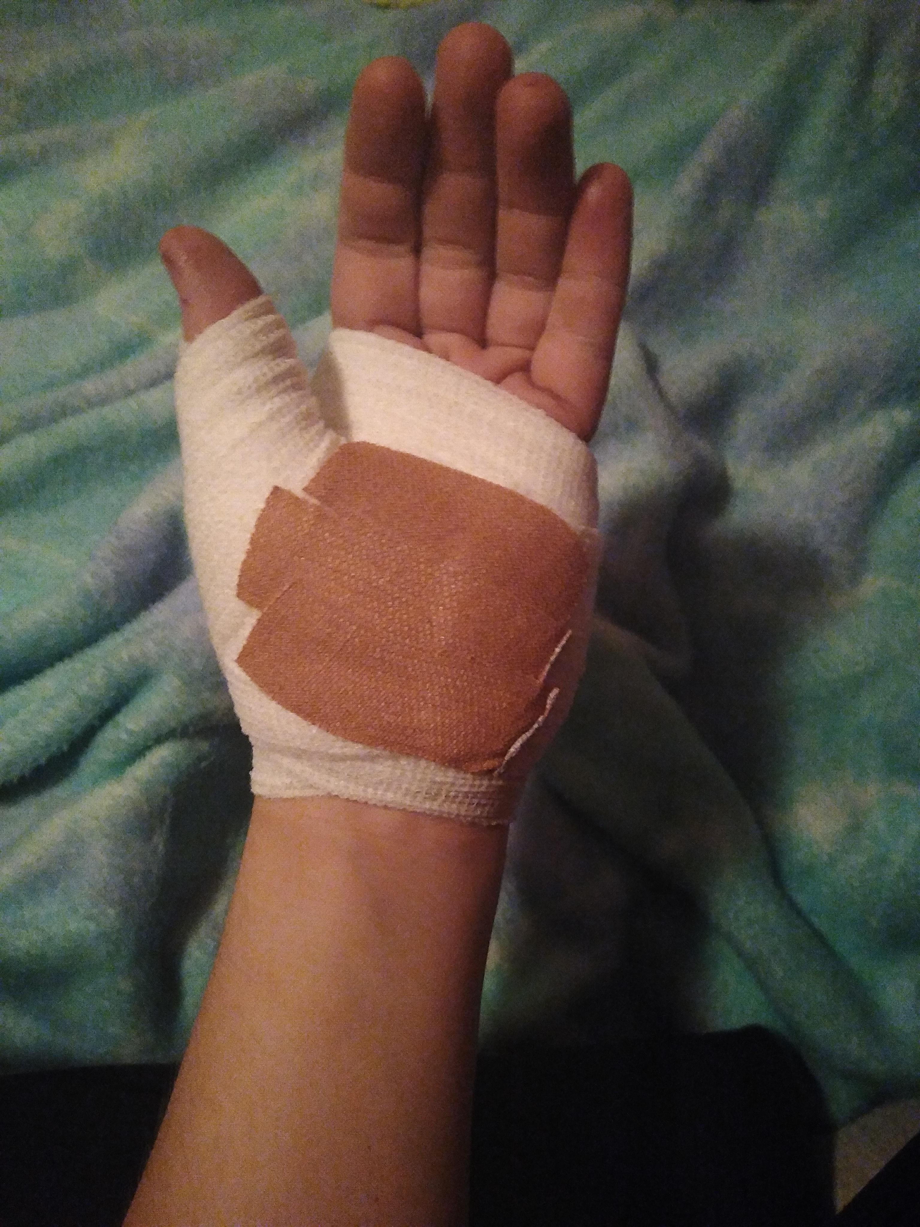 Dangers of the job. A&E jobbo last night after a shot glass broke in my