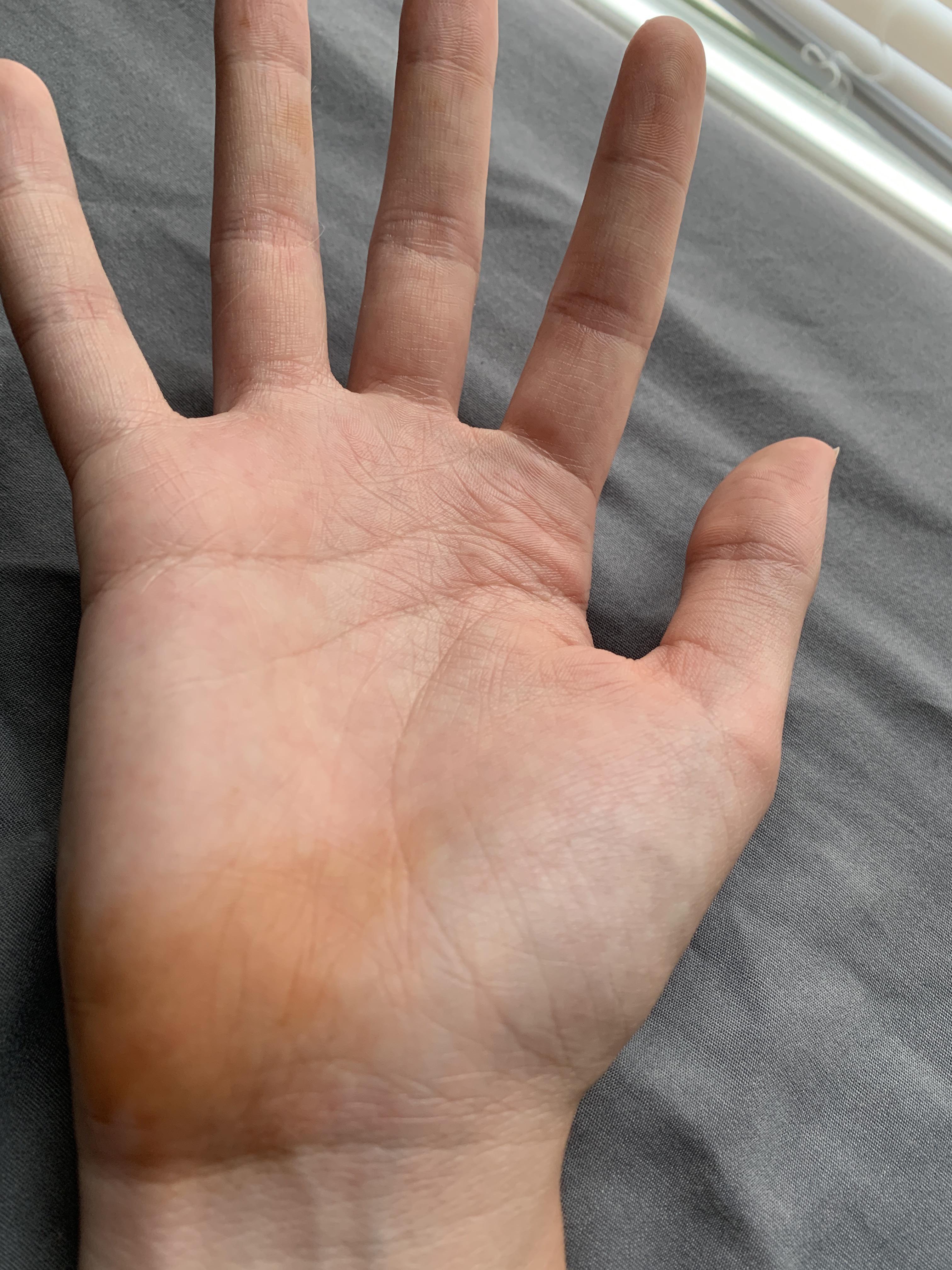 99 best Stained Skin images on Pholder Skincare Addiction, Makeup