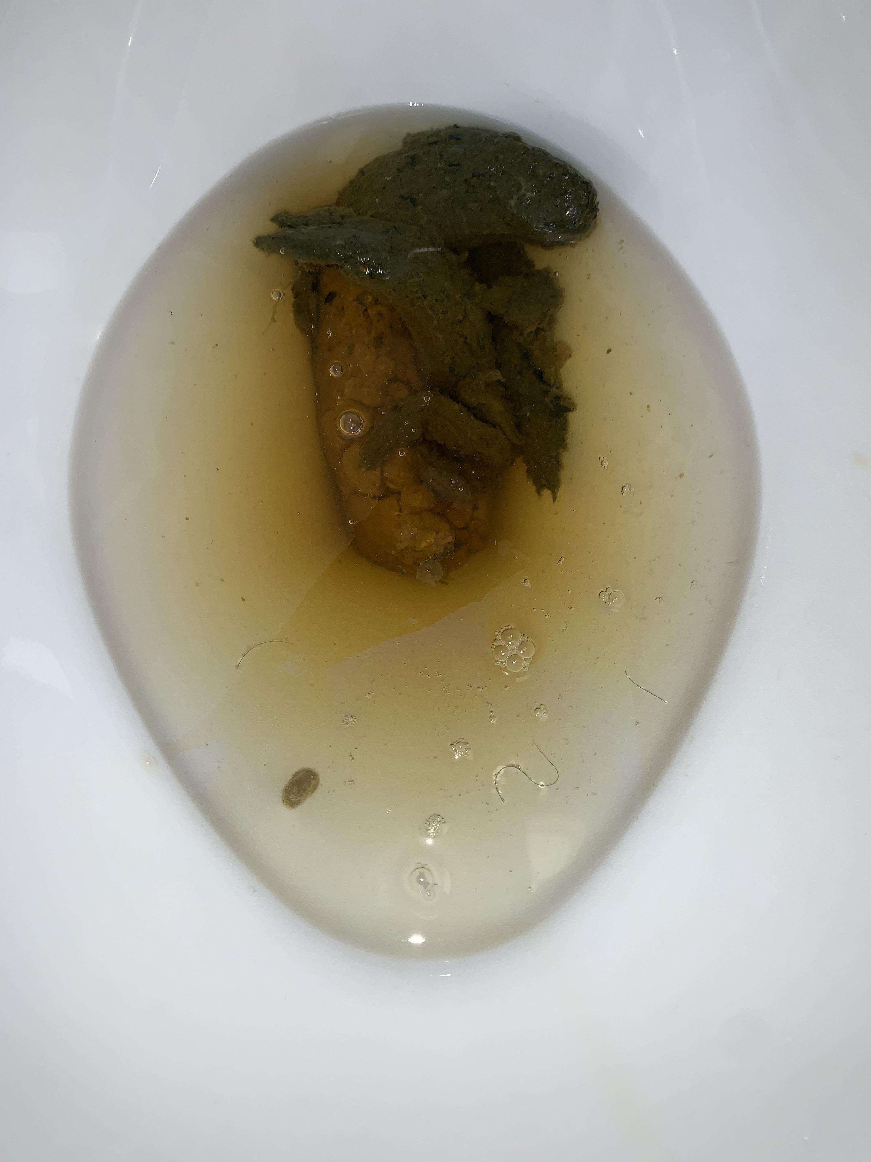 Steatorrhea? Anyone else with pancreatitis dealing with this? r