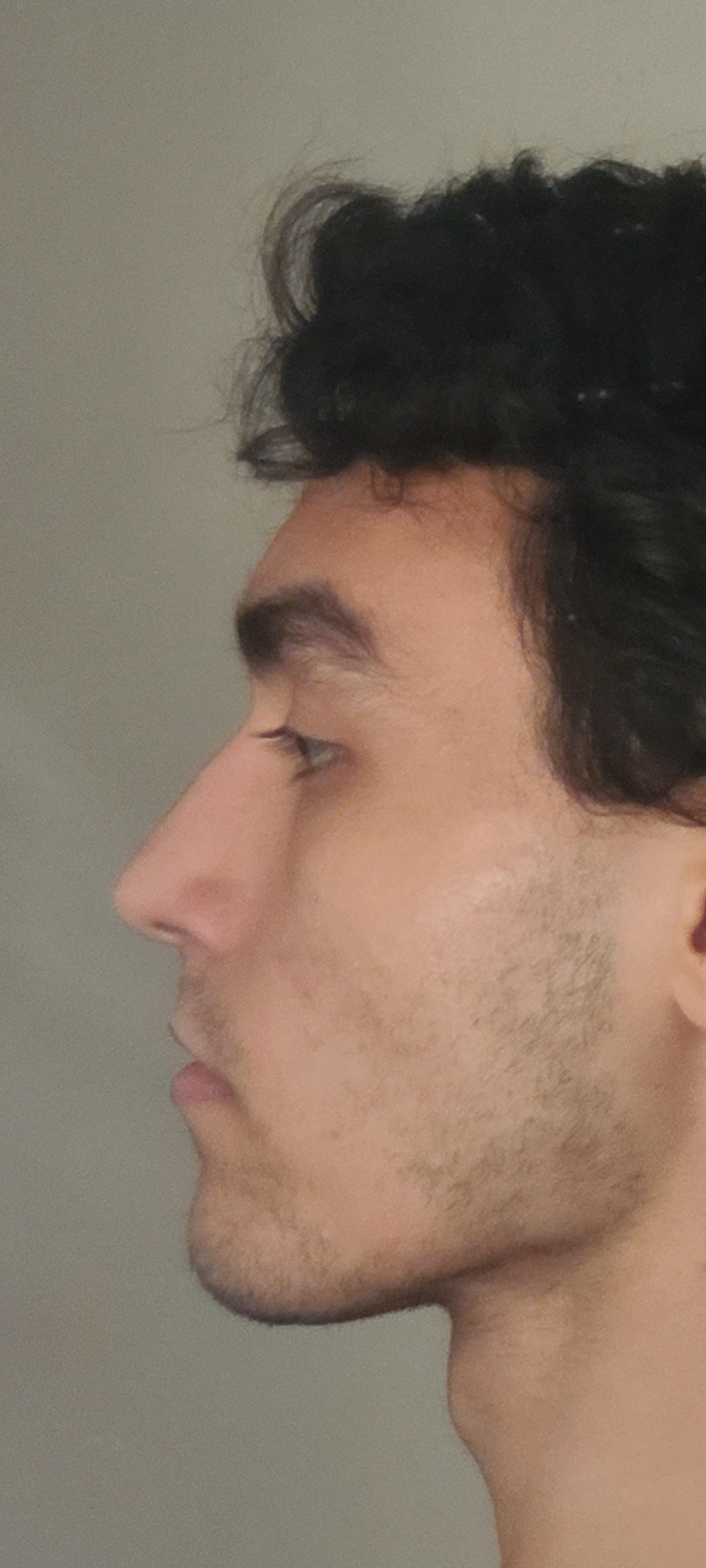 I'm Greek, but is my nose greek? r/Noses