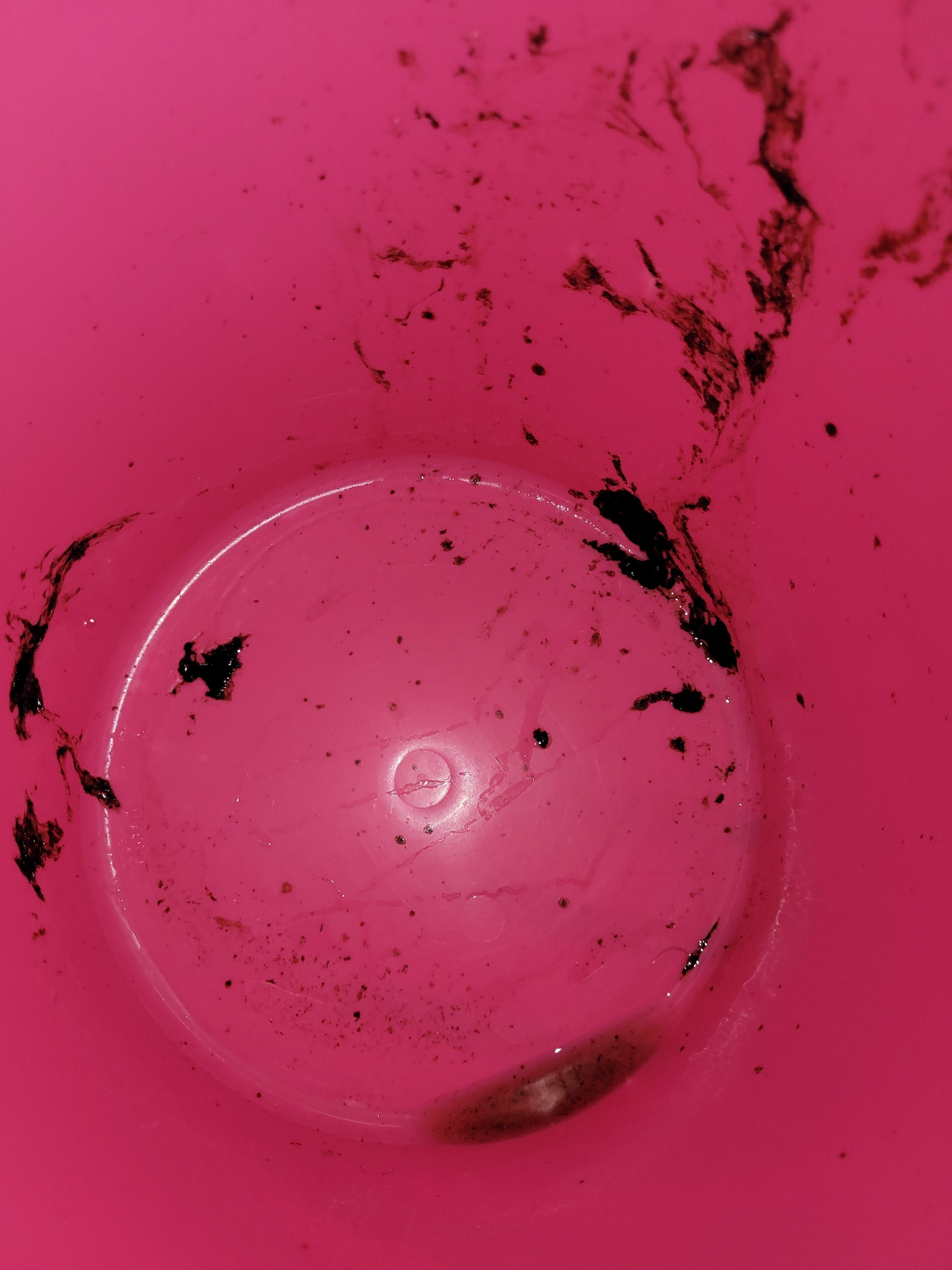 is this coffee ground vomit? i have more on my bedsheets. i drank too