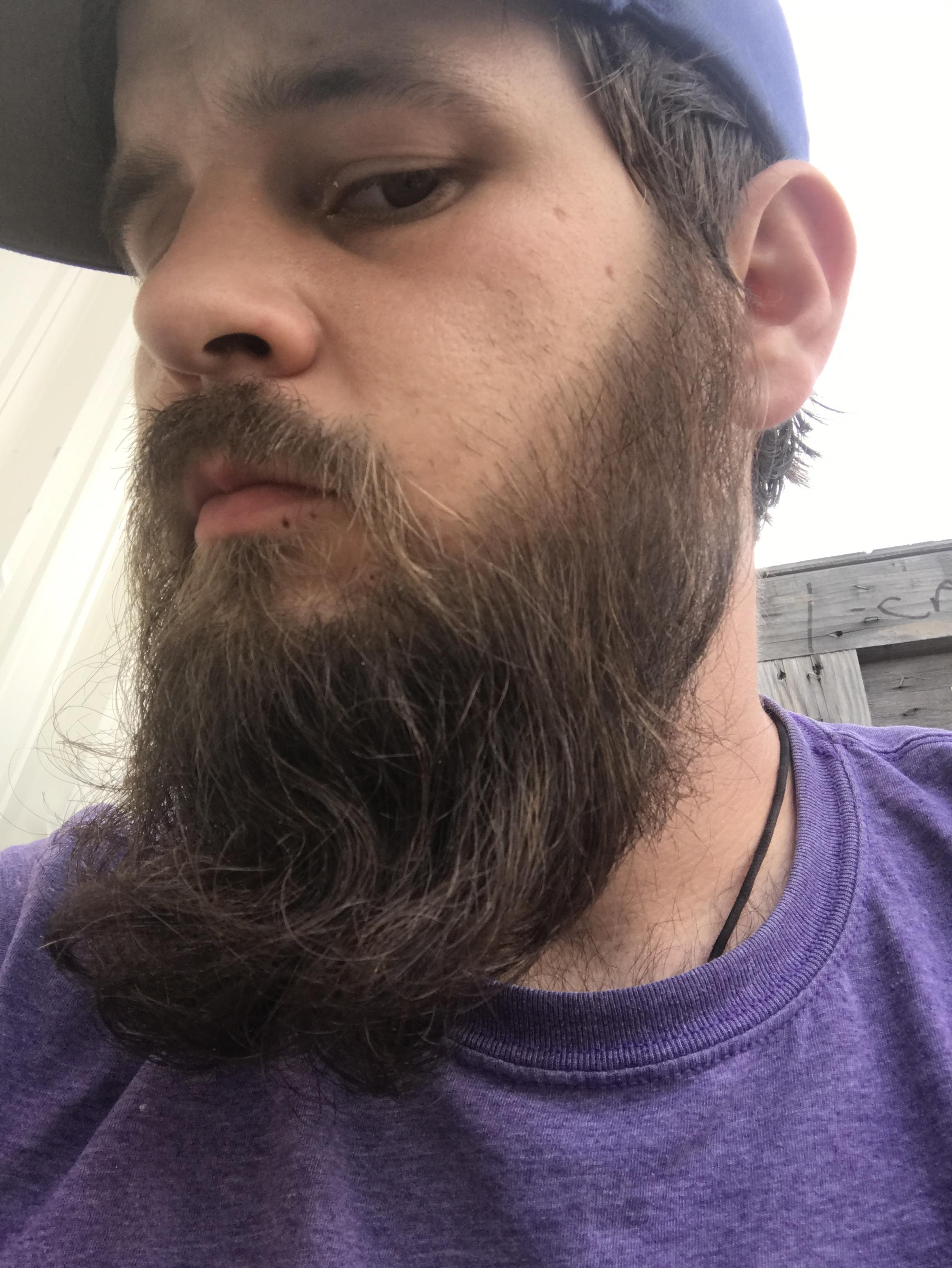 Beard Under Chin Only