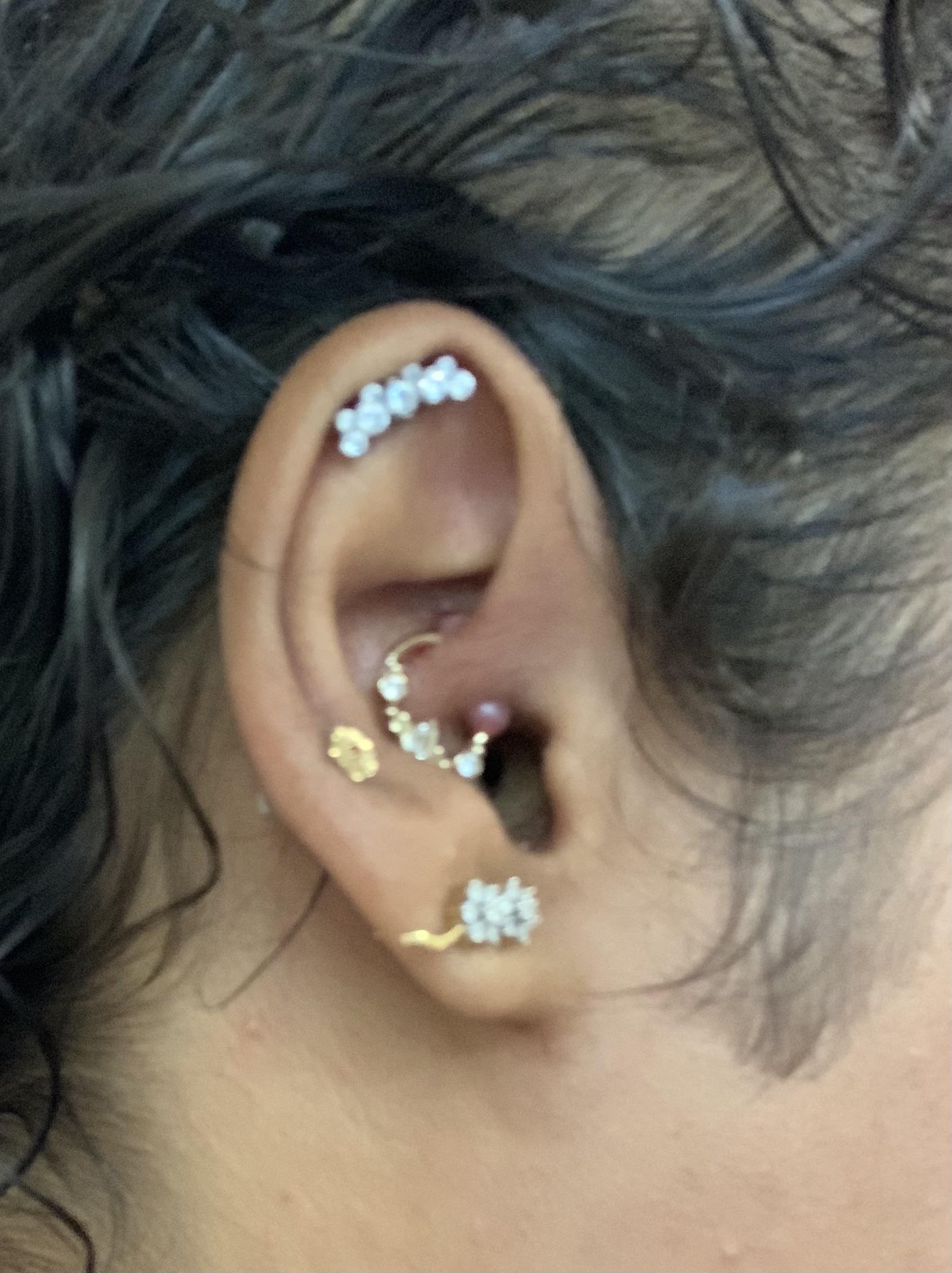 Daith piercing bumps help more info in comments piercing