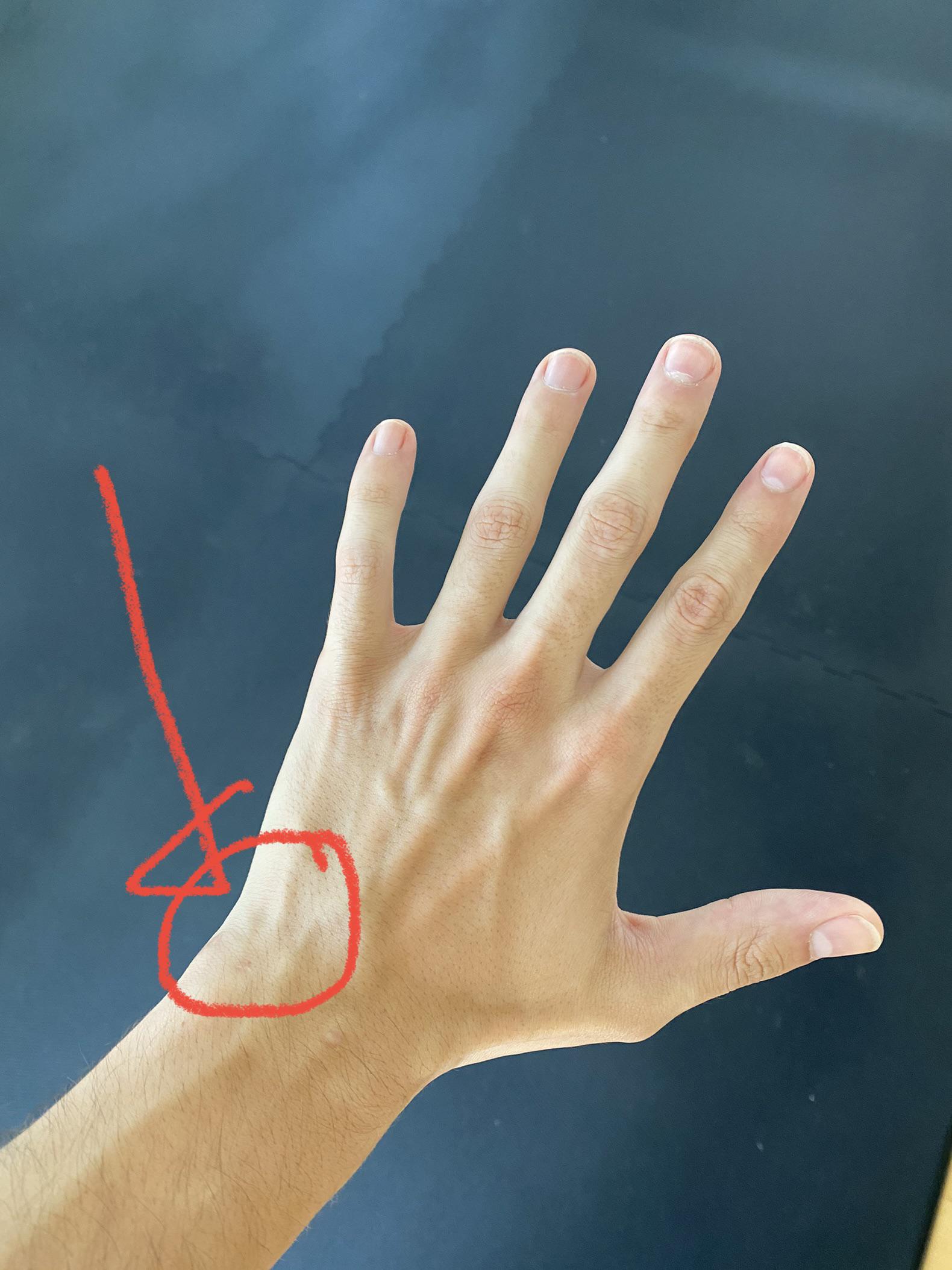 Wrist training/strengthening Left wrist pain ; How best to address