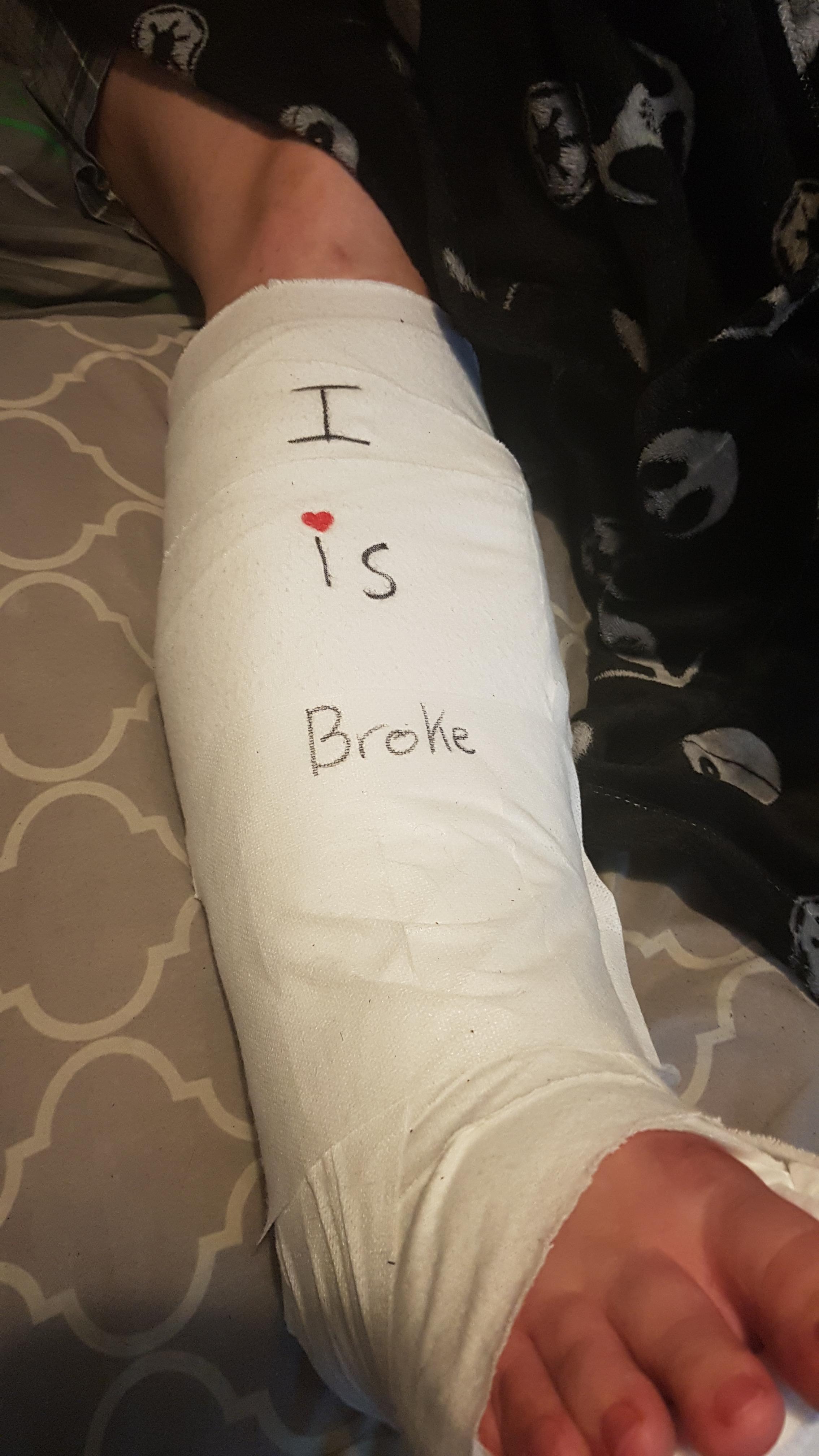 A picture of my broken leg r/notinteresting