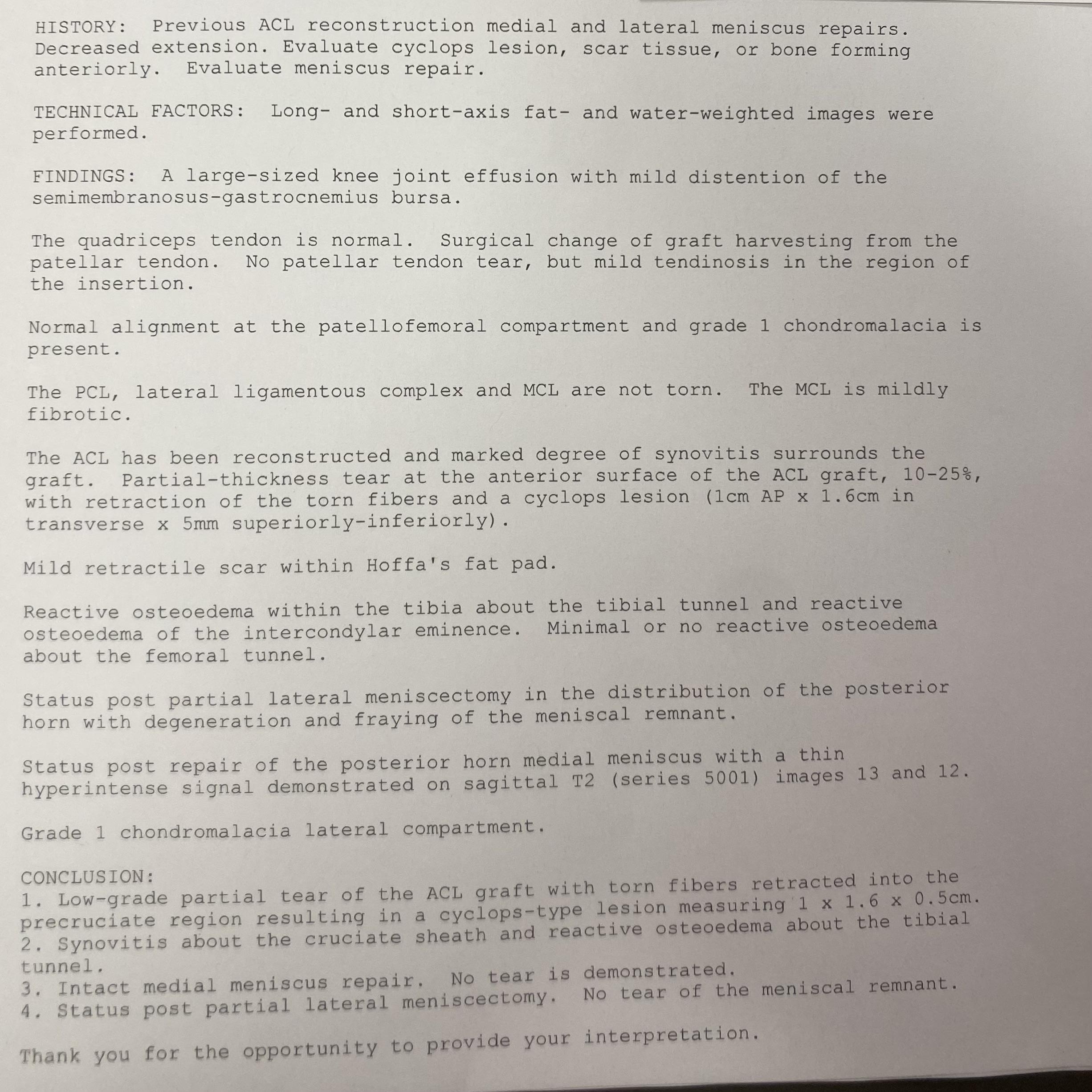 How to decide to get scar tissue removal procedure? r/ACL