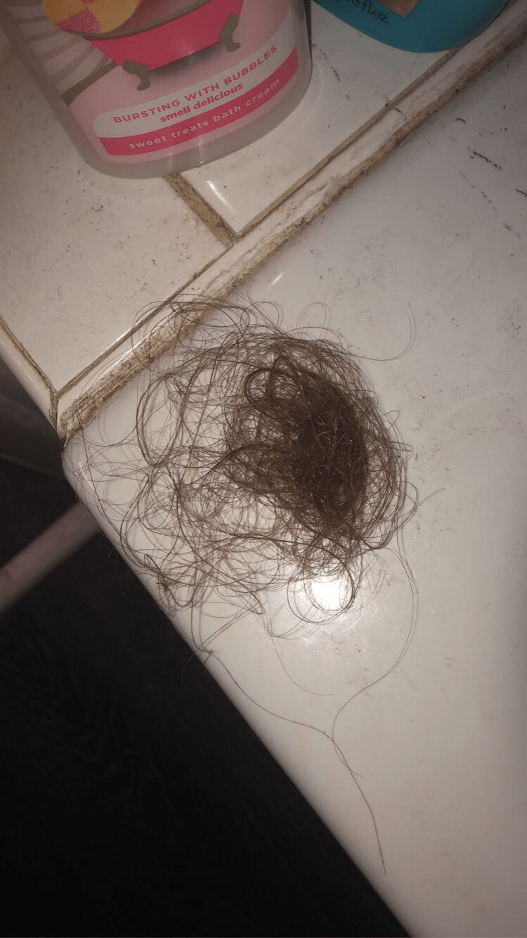 Is this too much hair falling out in the shower? I wash my hair every 7