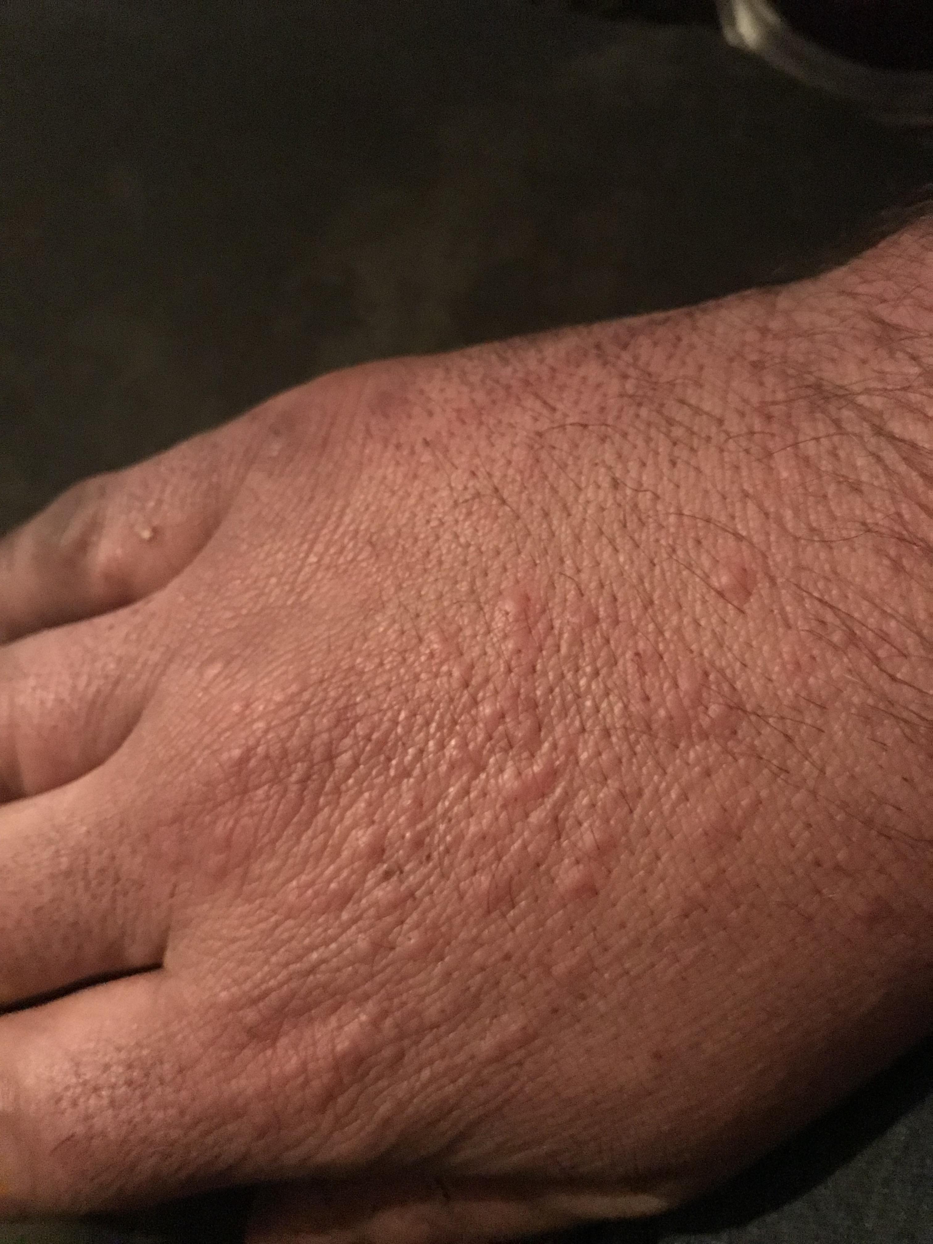 These bumps have been coming and going for over four years? Please help