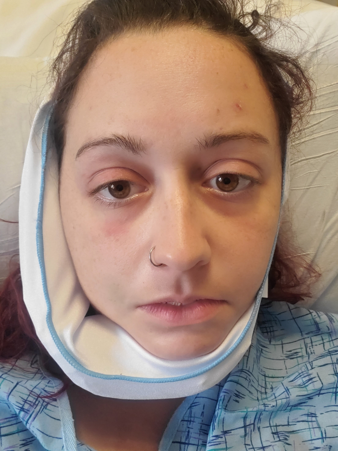 prolonged numbness after dental work reddit Katelin Greenwood